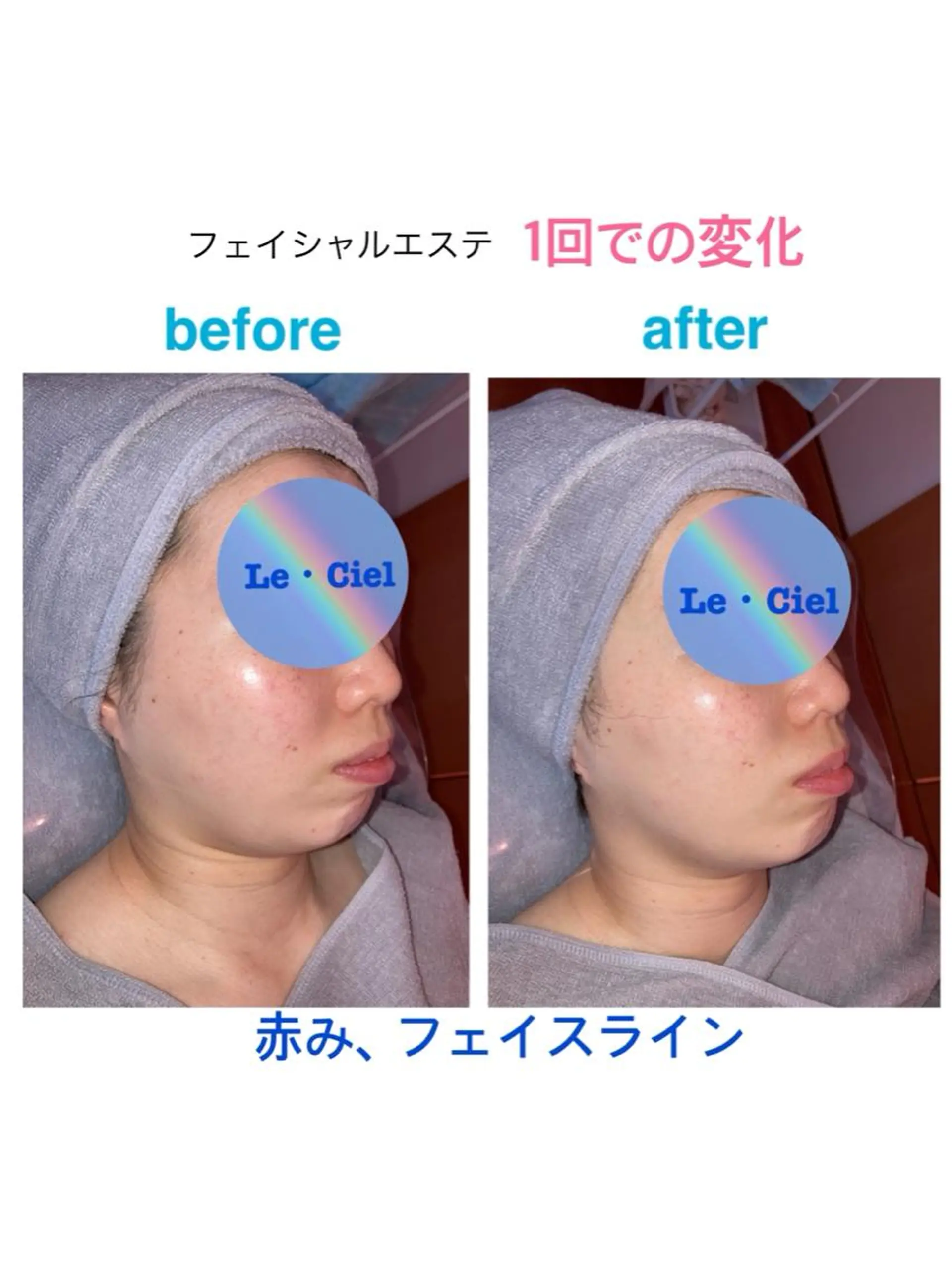 フェイシャルエステLe・Ciel所属・Le・Ciel フェイシャル&ボディのエステ・リラクイメージ