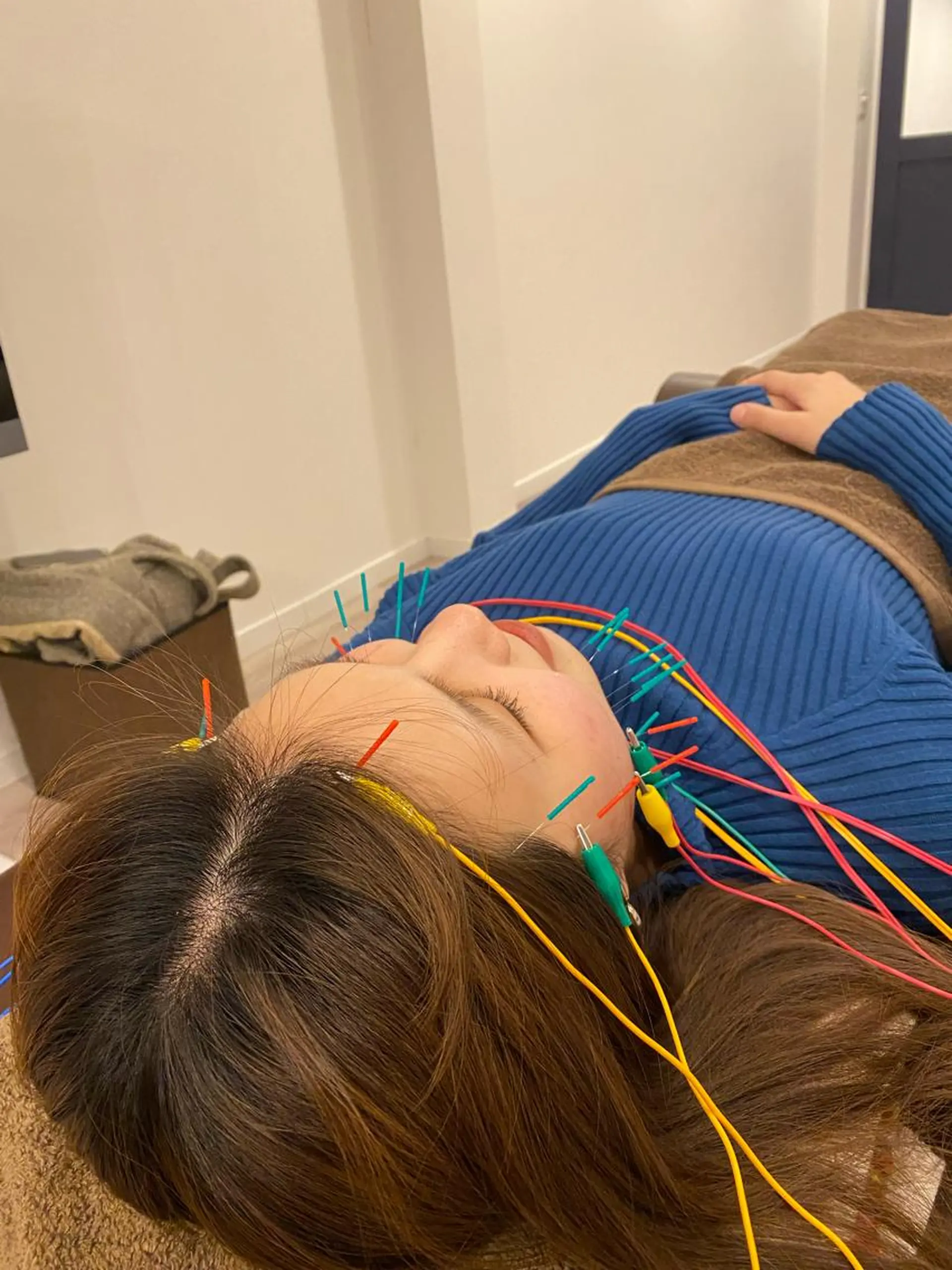 エステ リラク 美容鍼灸Solana所属・肌質改善×美容鍼 ゆいのエステ・リラクイメージ