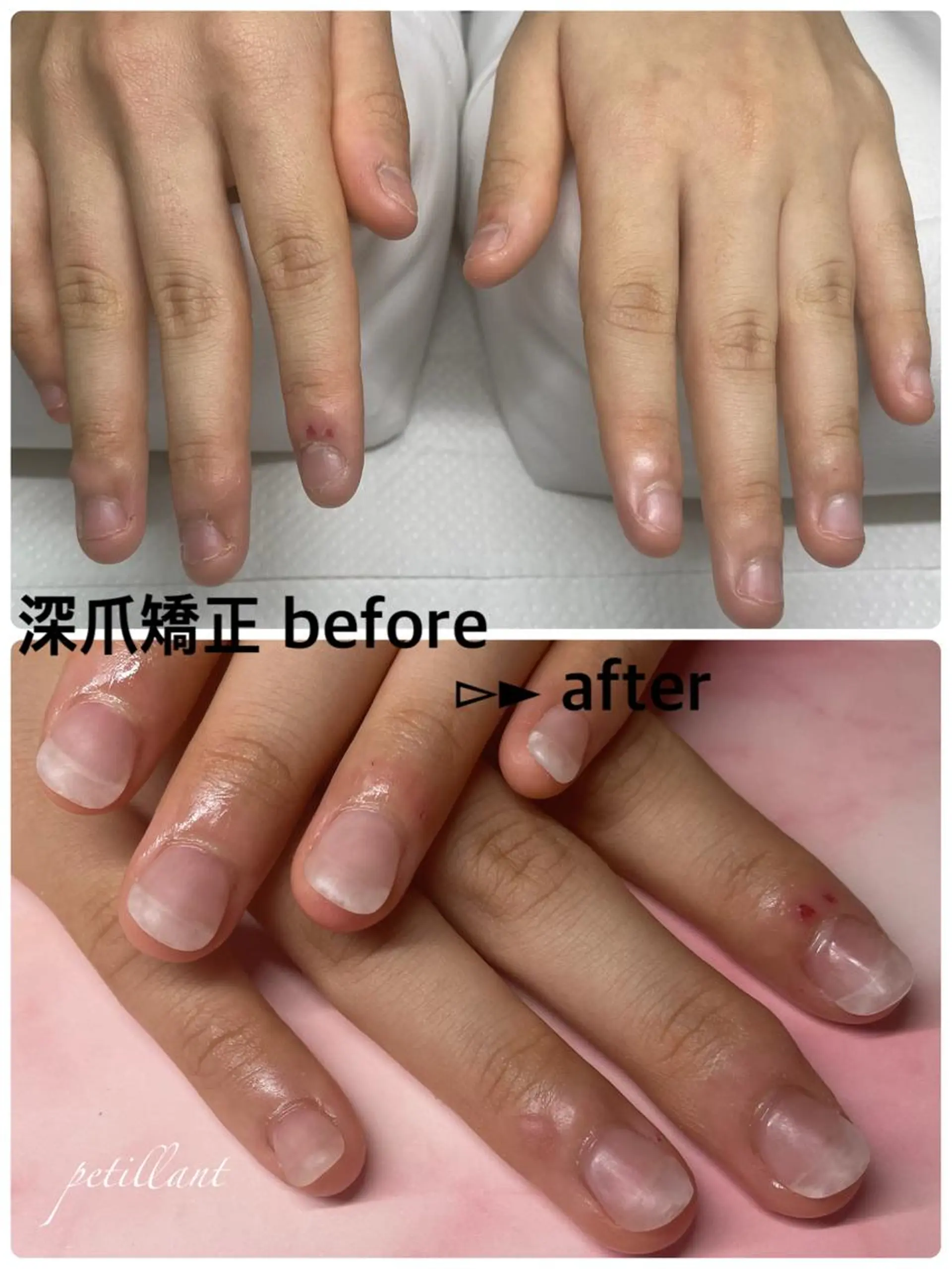 ネイル クリアネイル マットネイル petillant所属・nail salon petillantのネイルデザイン