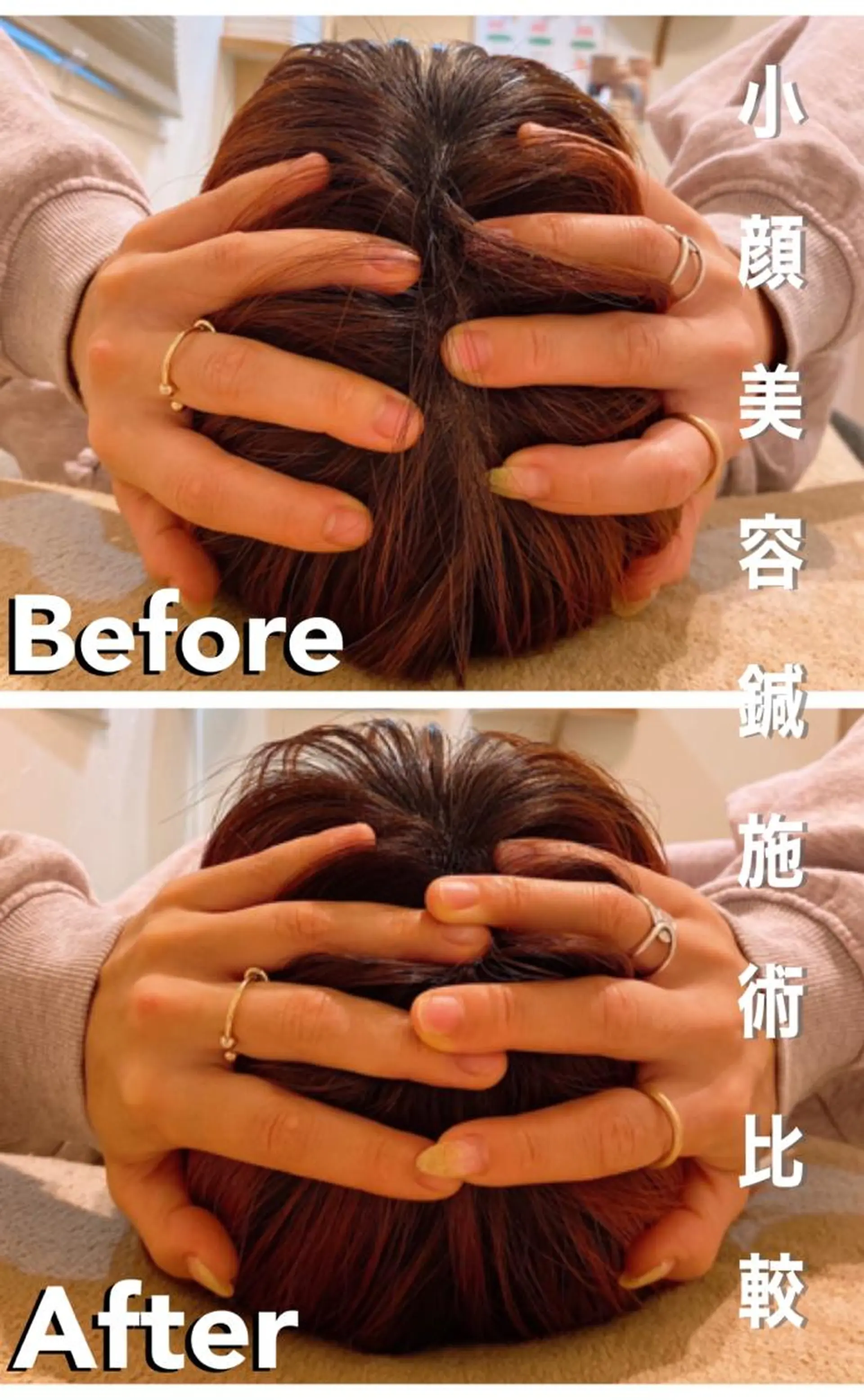 鍼灸整骨院Refine所属・鍼灸 Refineのその他イメージ