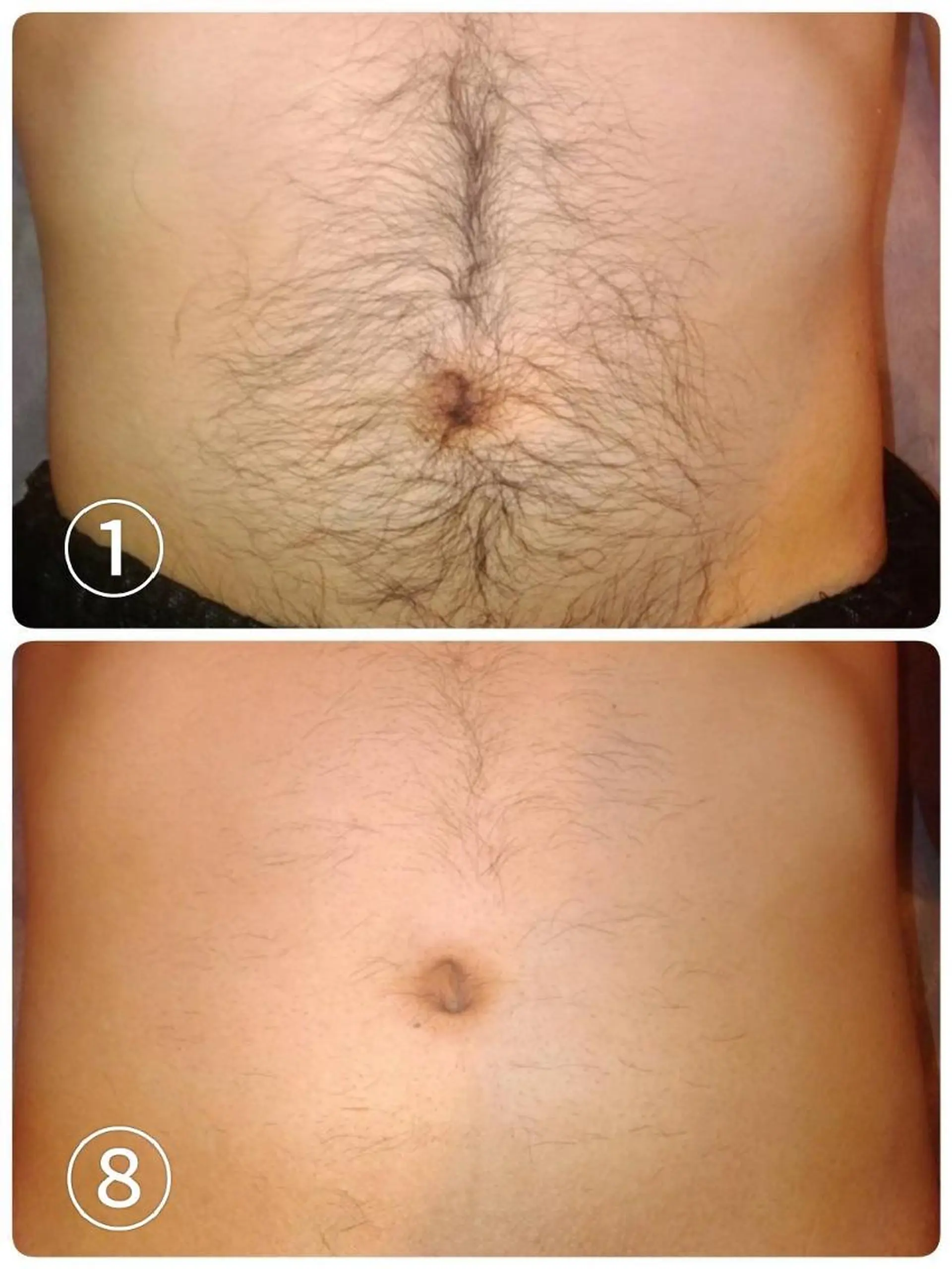 脱毛・眉毛・フェイス サロンN久留米店の眉毛・アイブロウイメージ