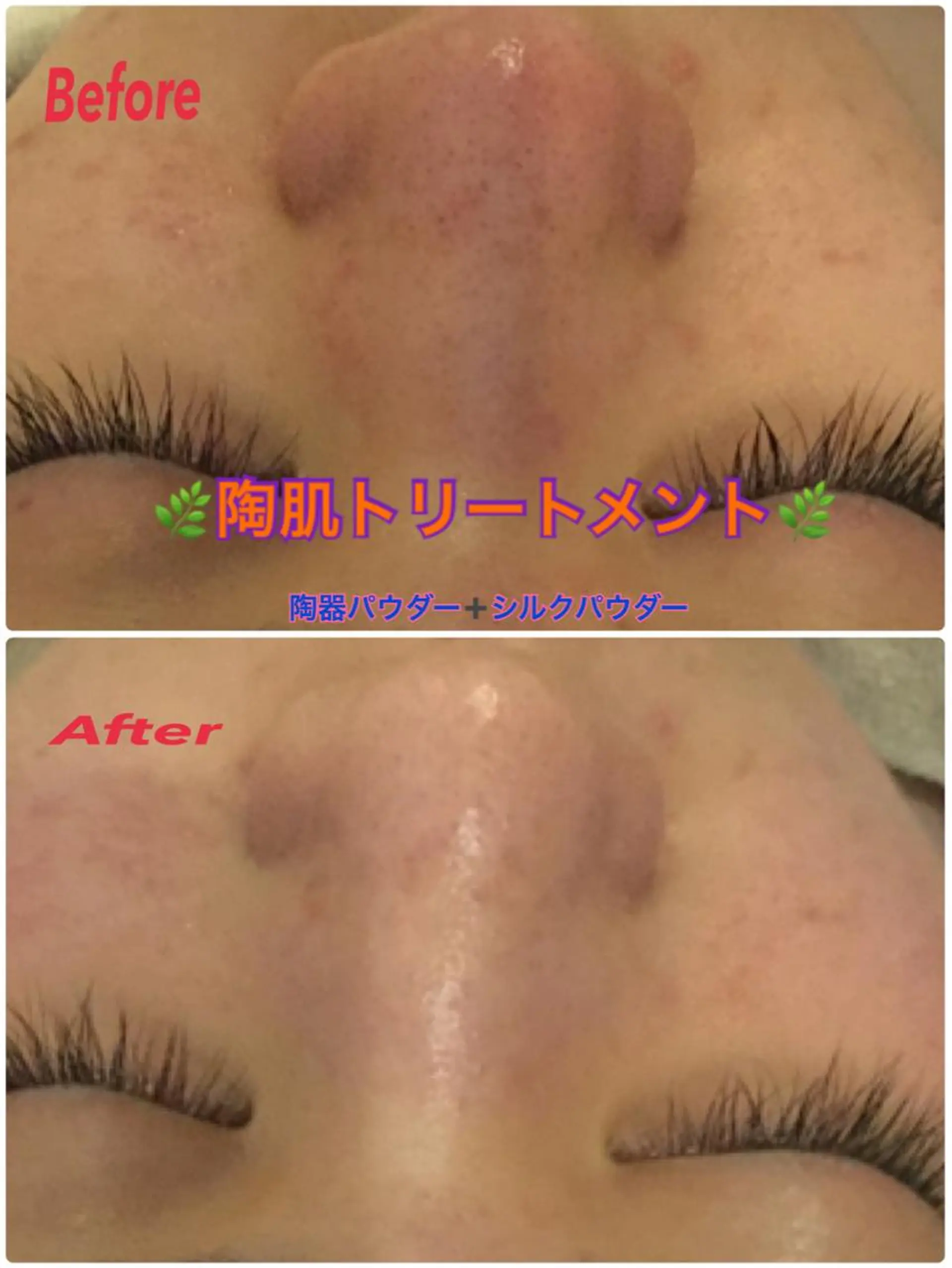 エステ 【リベルハーブピーリング認定店】敏感肌・美白脱毛専門店Dione立川店所属・Dione 立川店のエステ・リラクイメージ