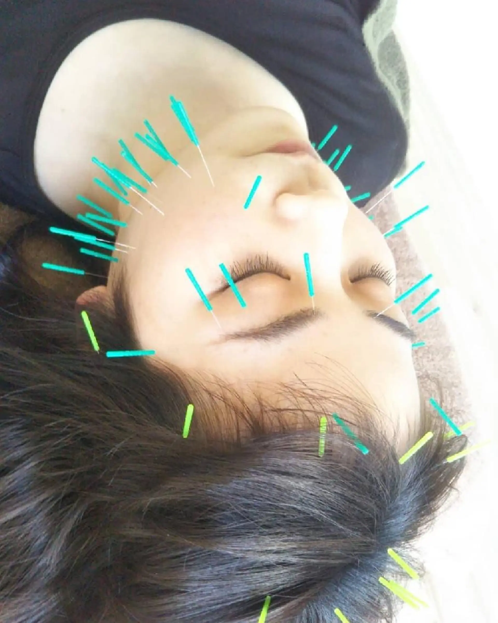 じゅうそう 鍼灸整骨院のエステ・リラクイメージ