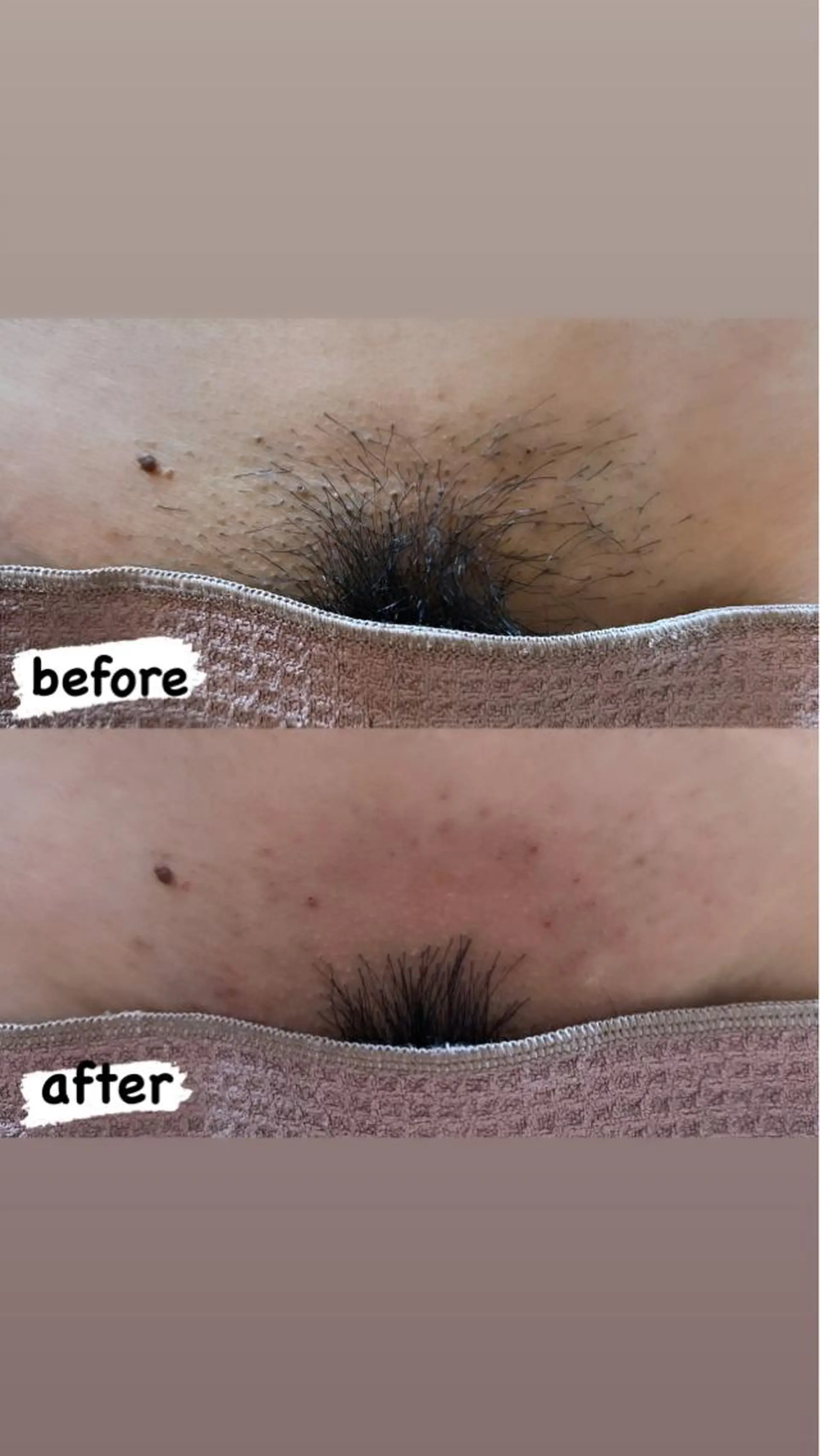 脱毛 Honey Salonのマツエク・マツパデザイン