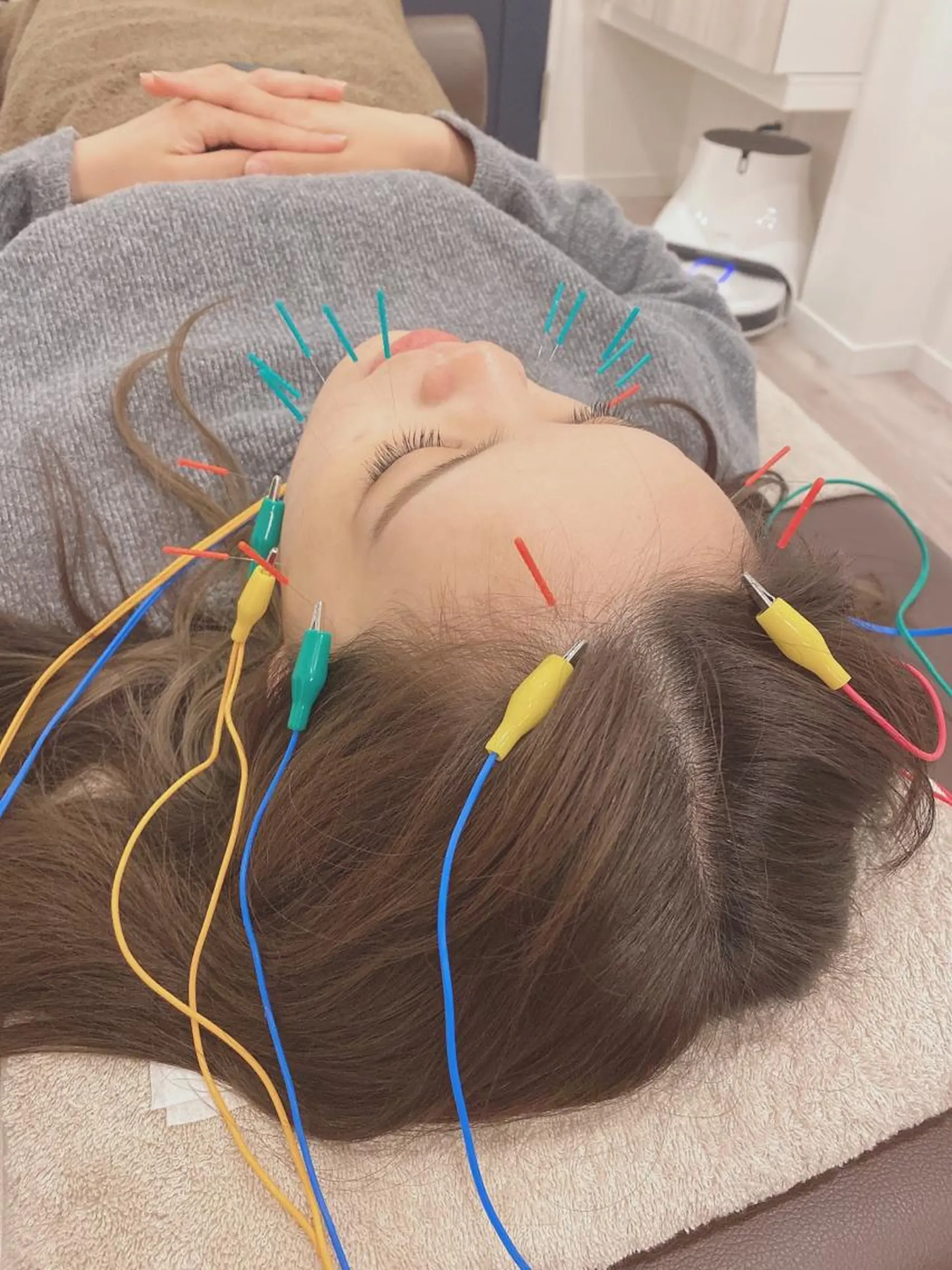 エステ リラク 美容鍼灸Solana所属・肌質改善×美容鍼 ゆいのエステ・リラクイメージ