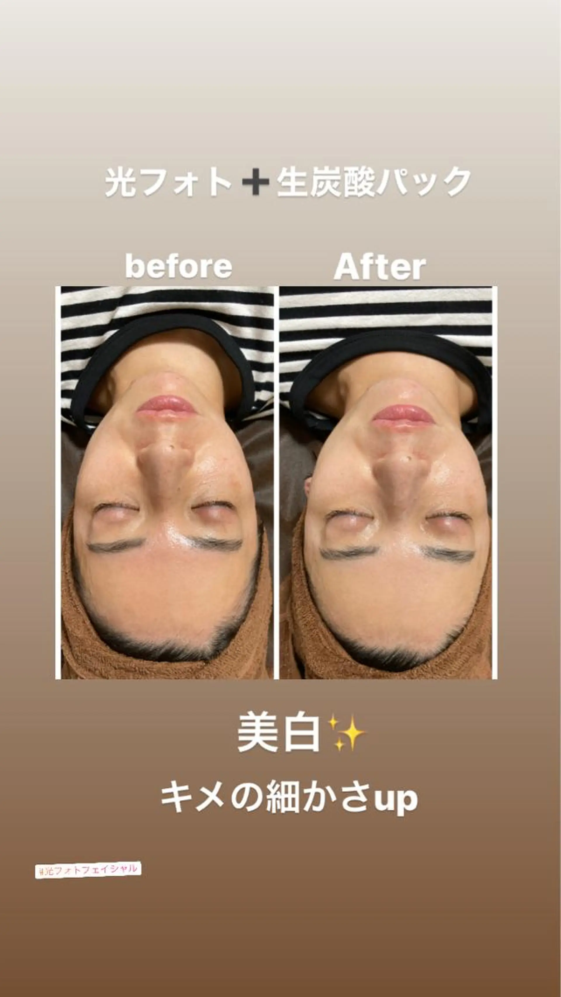 エステ 美顔秘密基地新宮所属・美顔秘密基地 新宮のその他イメージ