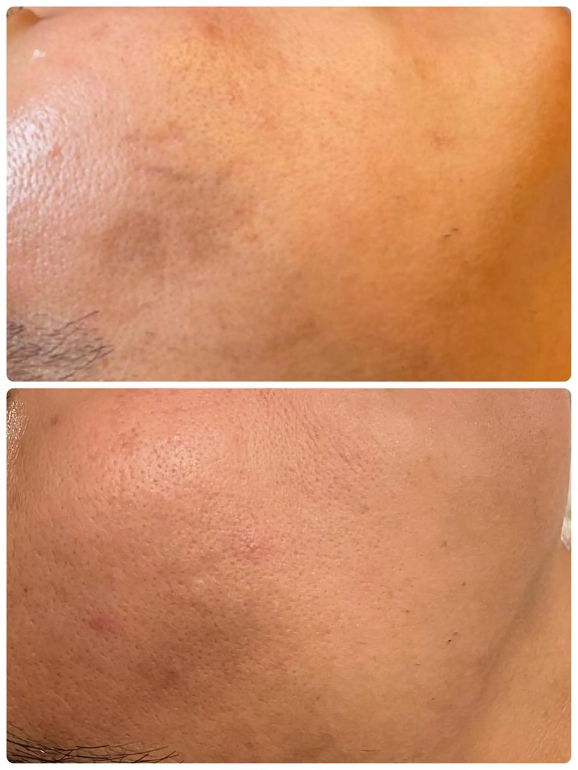 調律エステ /美KISSのその他イメージ