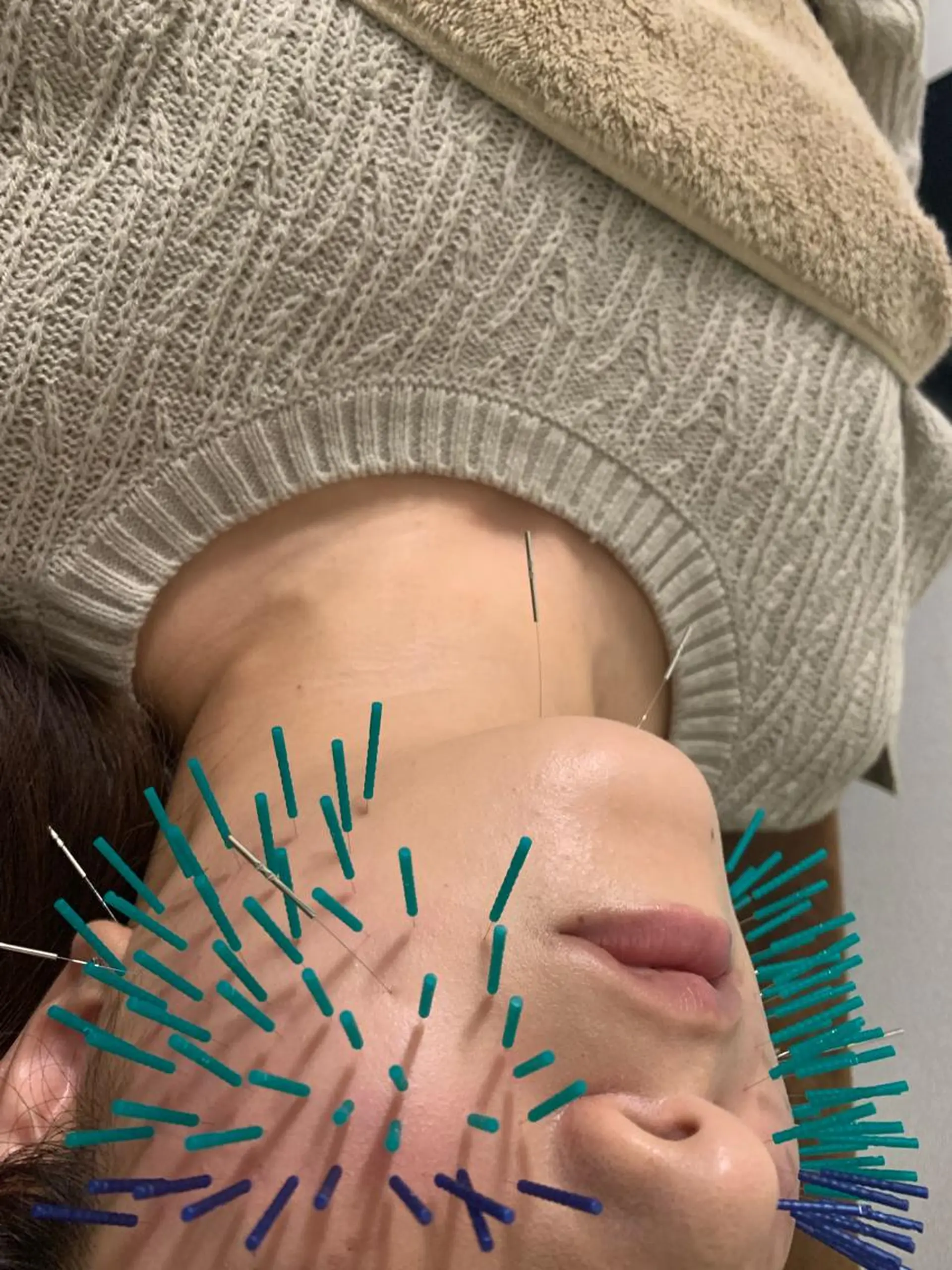 表参道鍼灸院K 美容鍼🔮ララピールのエステ・リラクイメージ