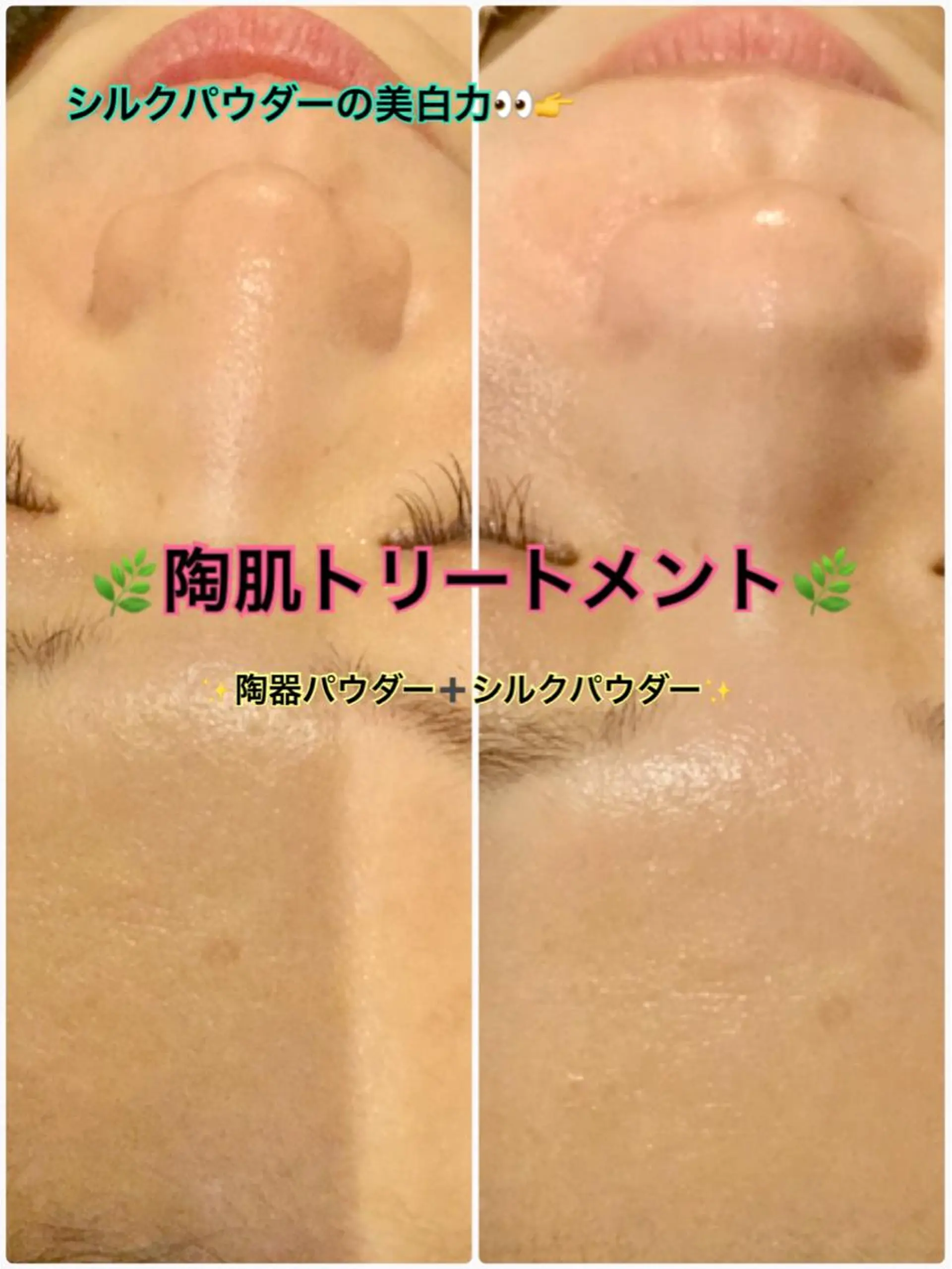 エステ 【リベルハーブピーリング認定店】敏感肌・美白脱毛専門店Dione立川店所属・Dione 立川店のエステ・リラクイメージ