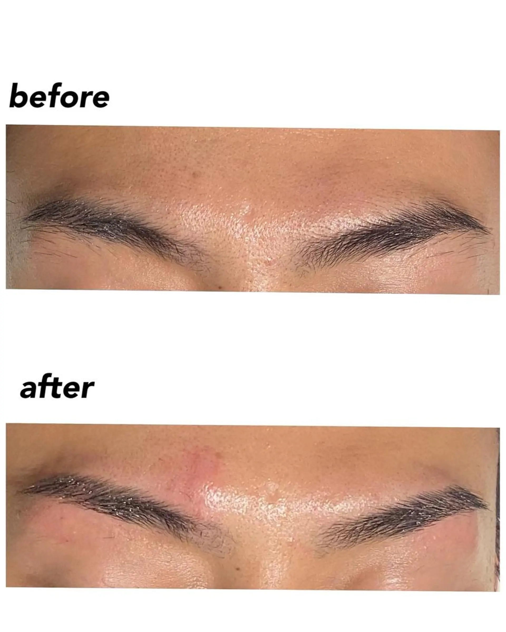 アイブロウ ハーブピーリング/韓国肌管理/フェイシャル/毛穴洗浄/眉毛/顔脱毛【糸脱毛専門】rev所属・ハーブピーリング🌹 毛穴洗浄❤️眉waxのエステ・リラクイメージ