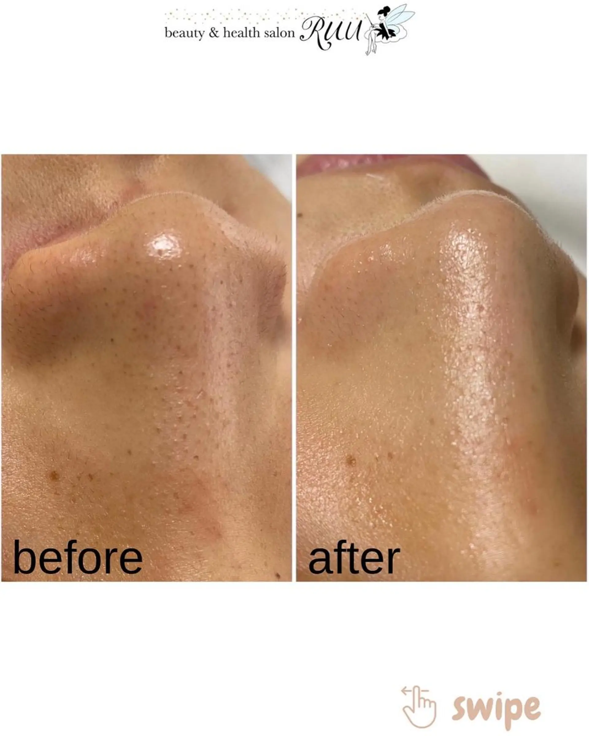 【頭痛、睡眠改善】 salon RUUのエステ・リラクイメージ