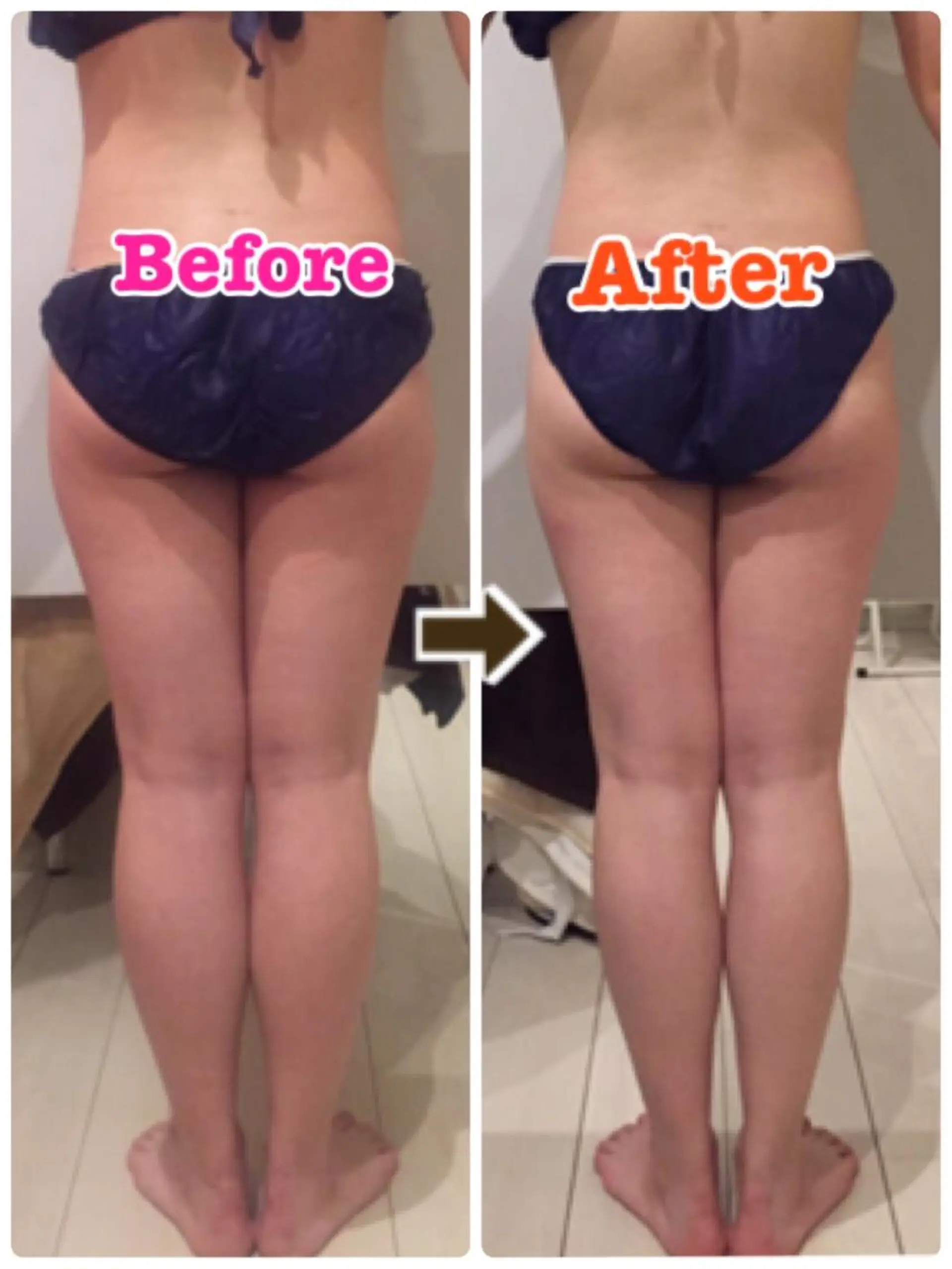 ショート カラー パーマ ヘアアレンジ メンズ キッズ ネイル マツエク・マツパ ‍痩身＆ボディ 結果出し🌟丹野のエステ・リラクイメージ