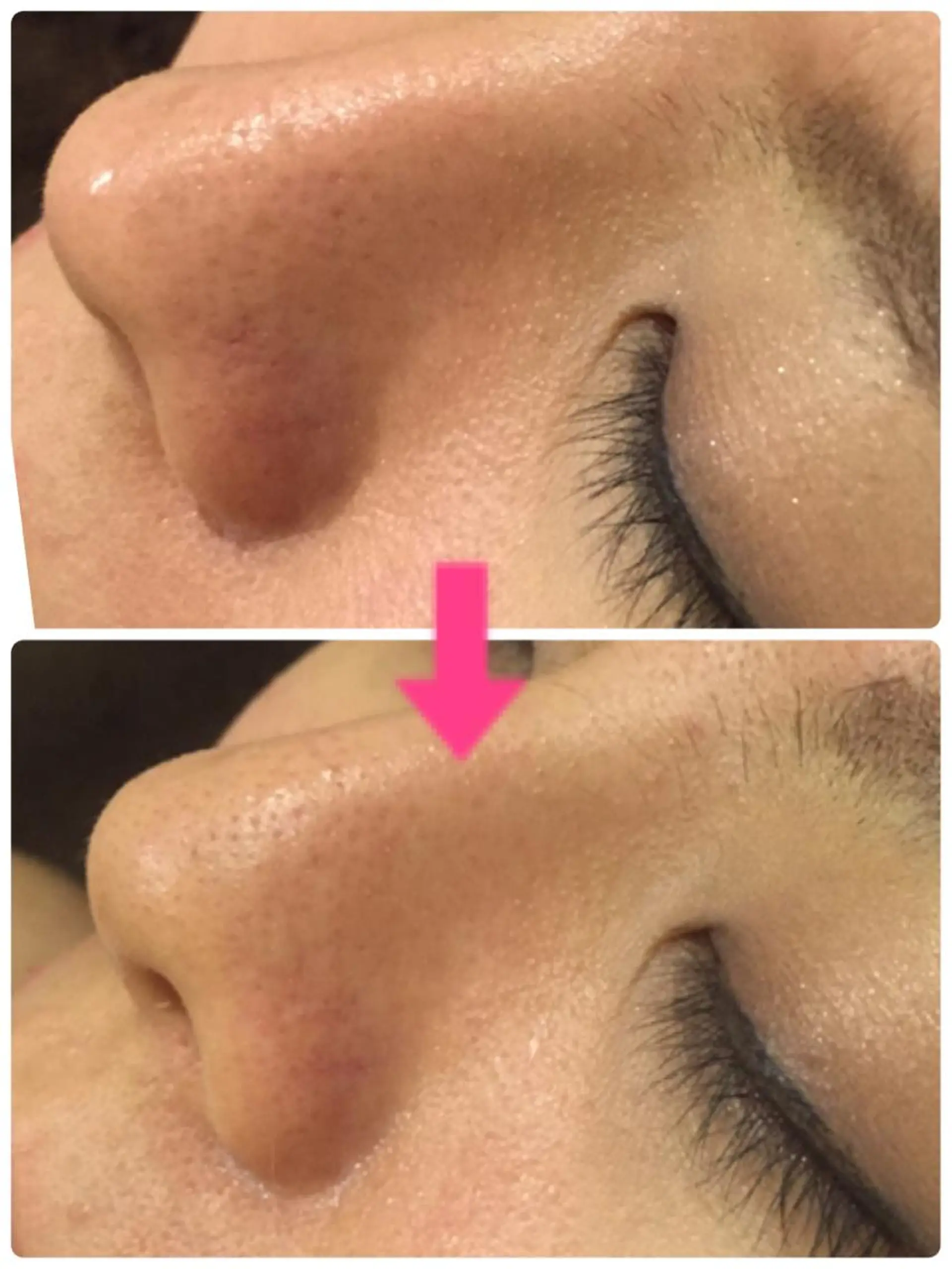 ショート カラー パーマ ヘアアレンジ メンズ キッズ ネイル マツエク・マツパ 赤色 ‍痩身＆ボディ 結果出し🌟丹野のエステ・リラクイメージ