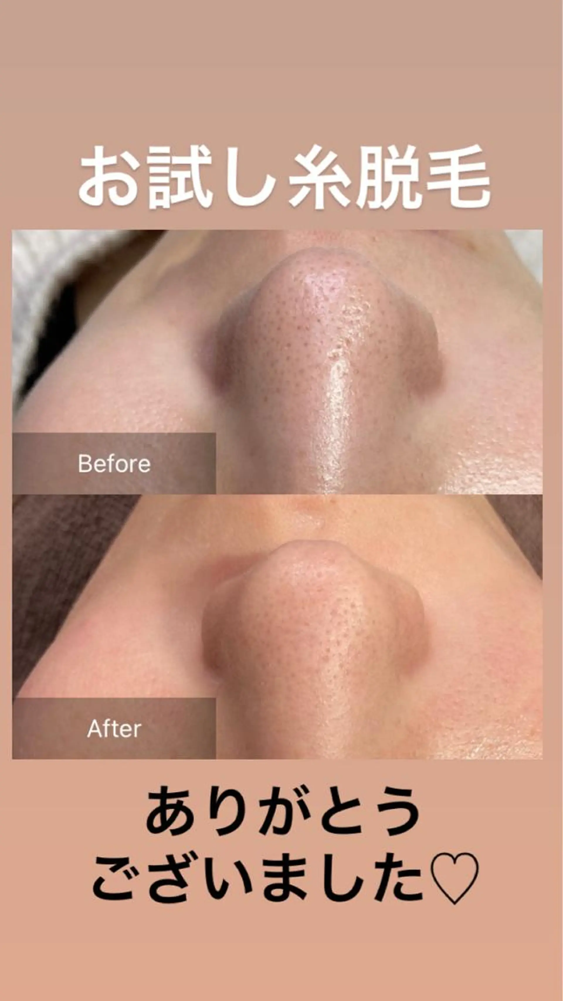 エステ 産毛専門店 Bittoのエステ・リラクイメージ