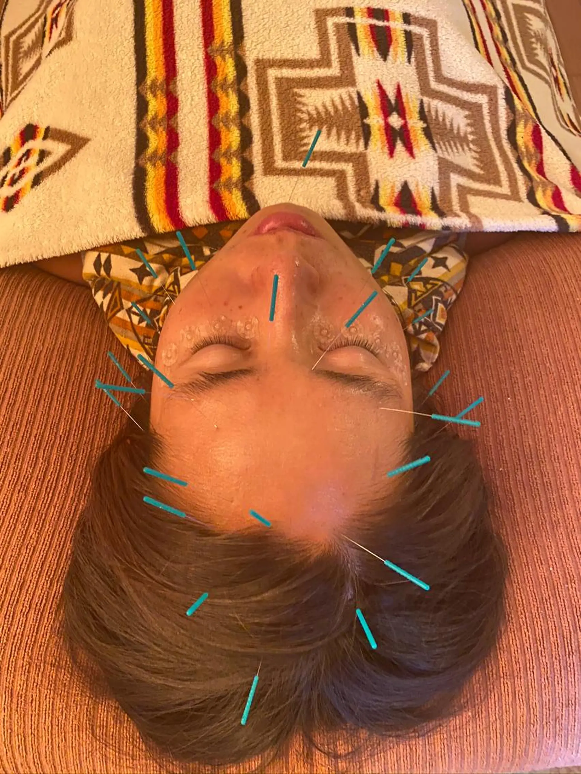 エステ リラク Relama　美容鍼×マッサージ所属・Relama/リラマ 美容鍼×マッサージのエステ・リラクイメージ