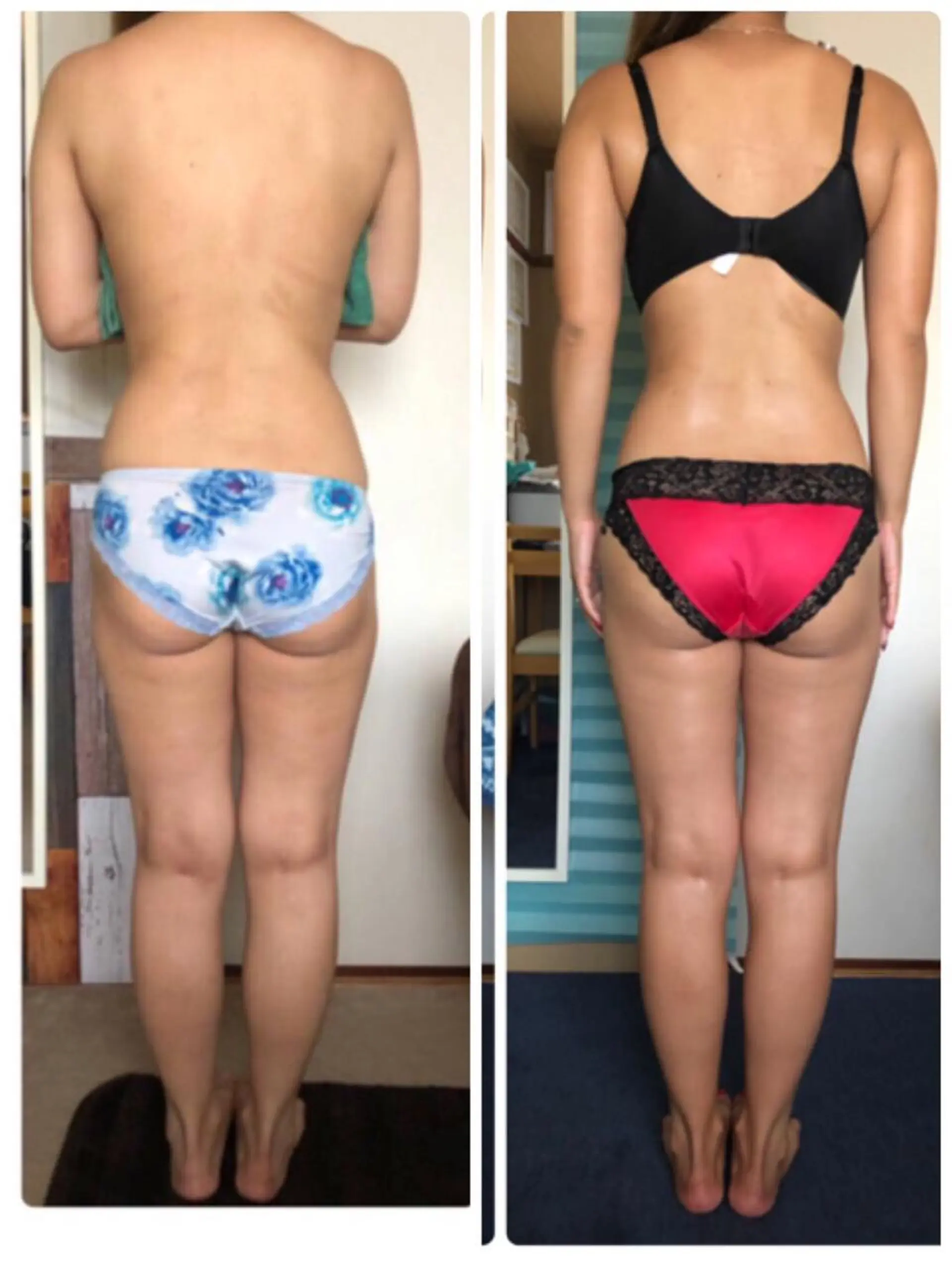 ミリ ミリのエステ・リラクイメージ