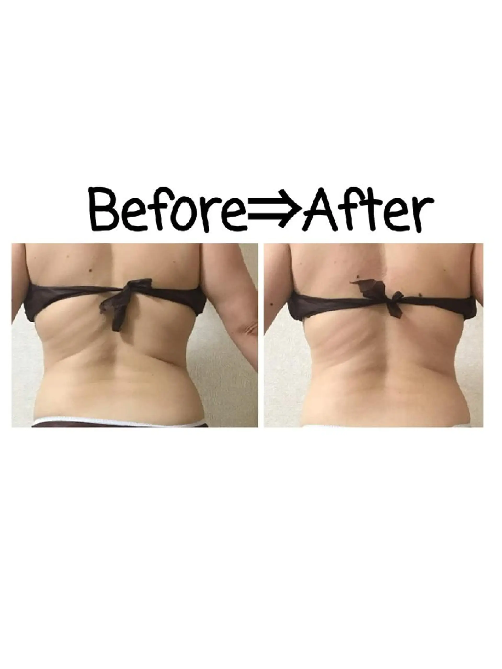 撮影モデル TotalBeauty　axis所属・本気の痩身🕊渡邊 明子🕊のその他イメージ