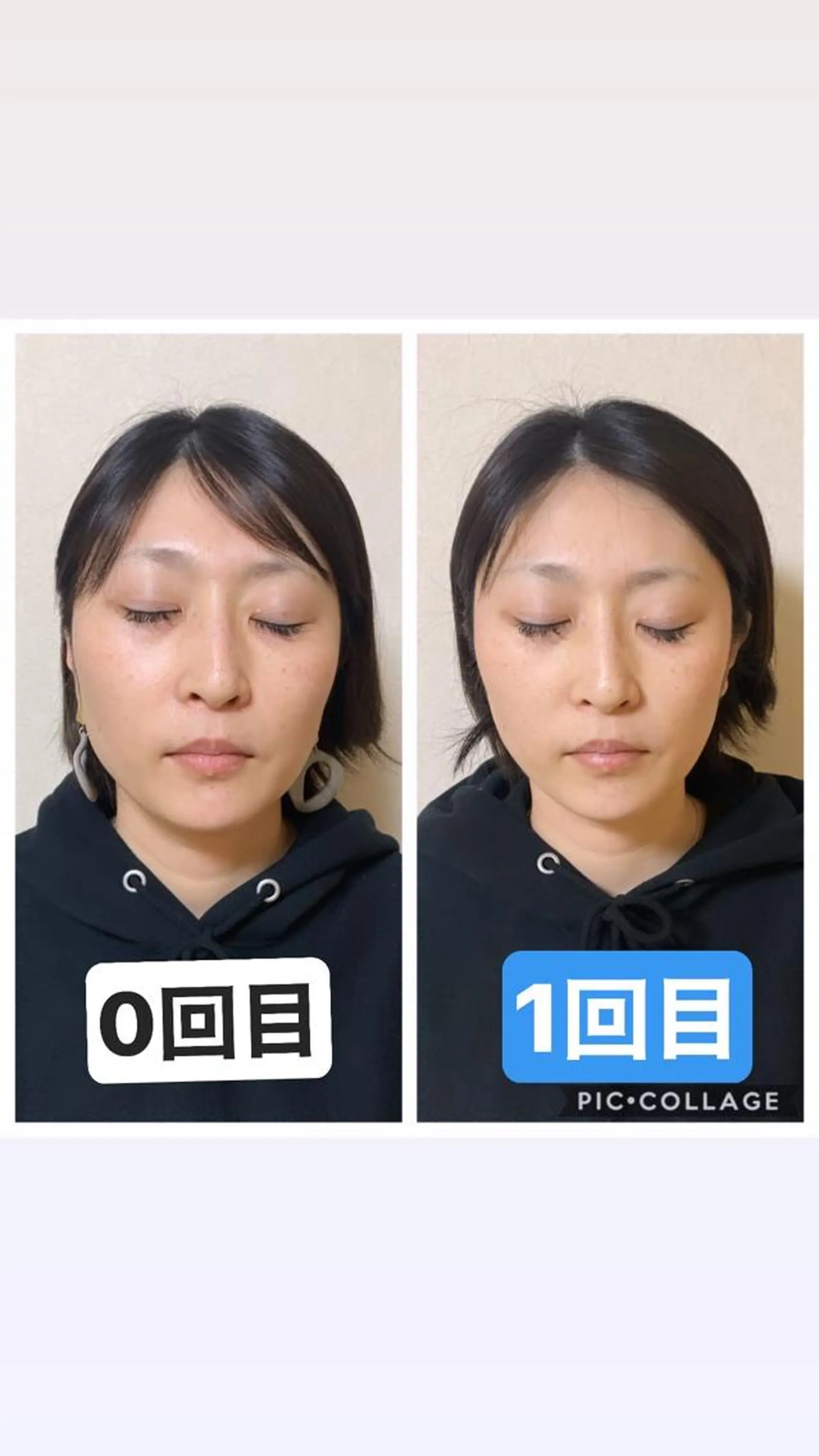 エステ リラク インタークロス所属・小顔矯正専門TIAM インタークロス池袋店のエステ・リラクイメージ