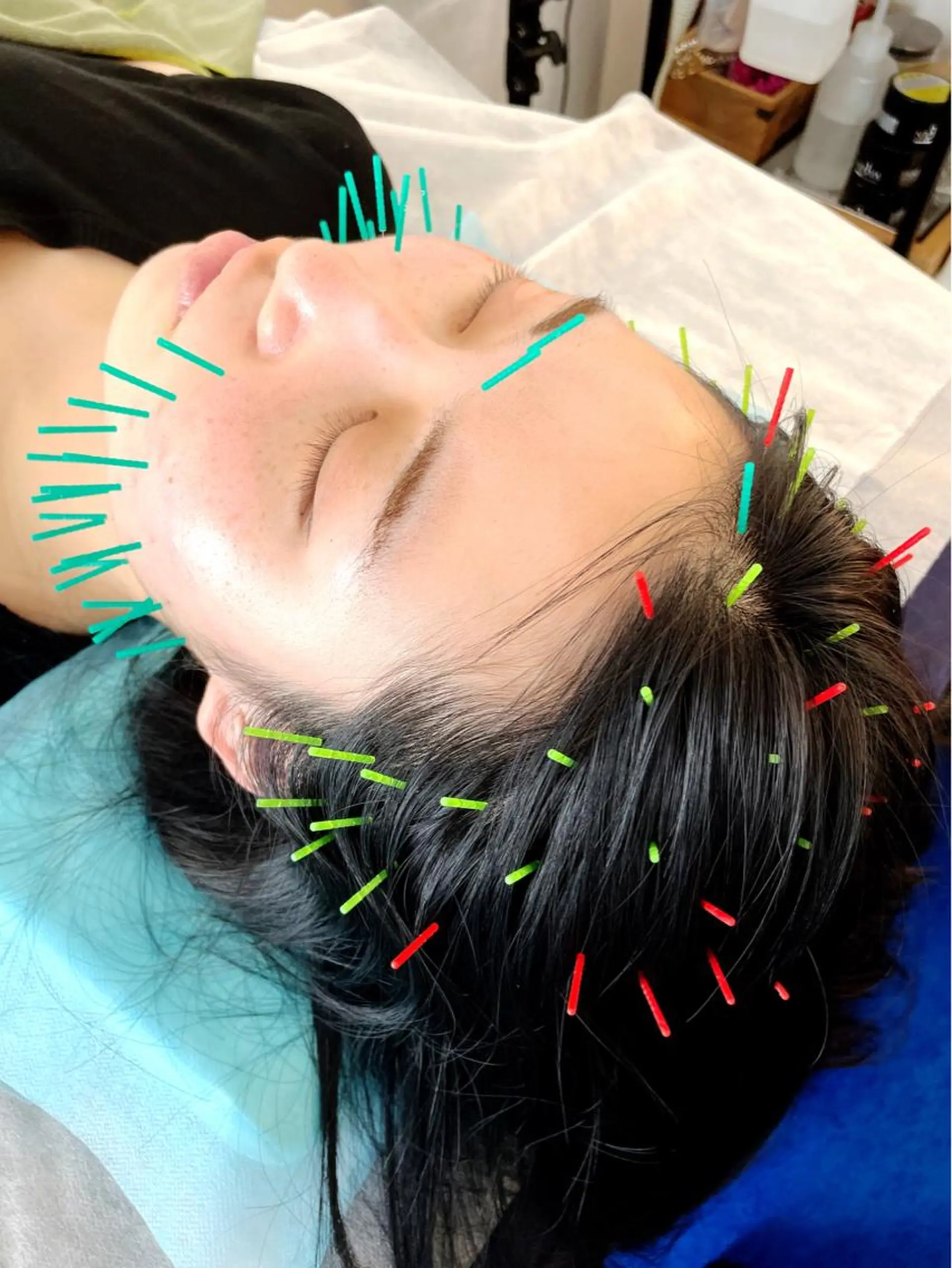 エステ リラク 小顔美容鍼専門サロン 渋谷YZのエステ・リラクイメージ