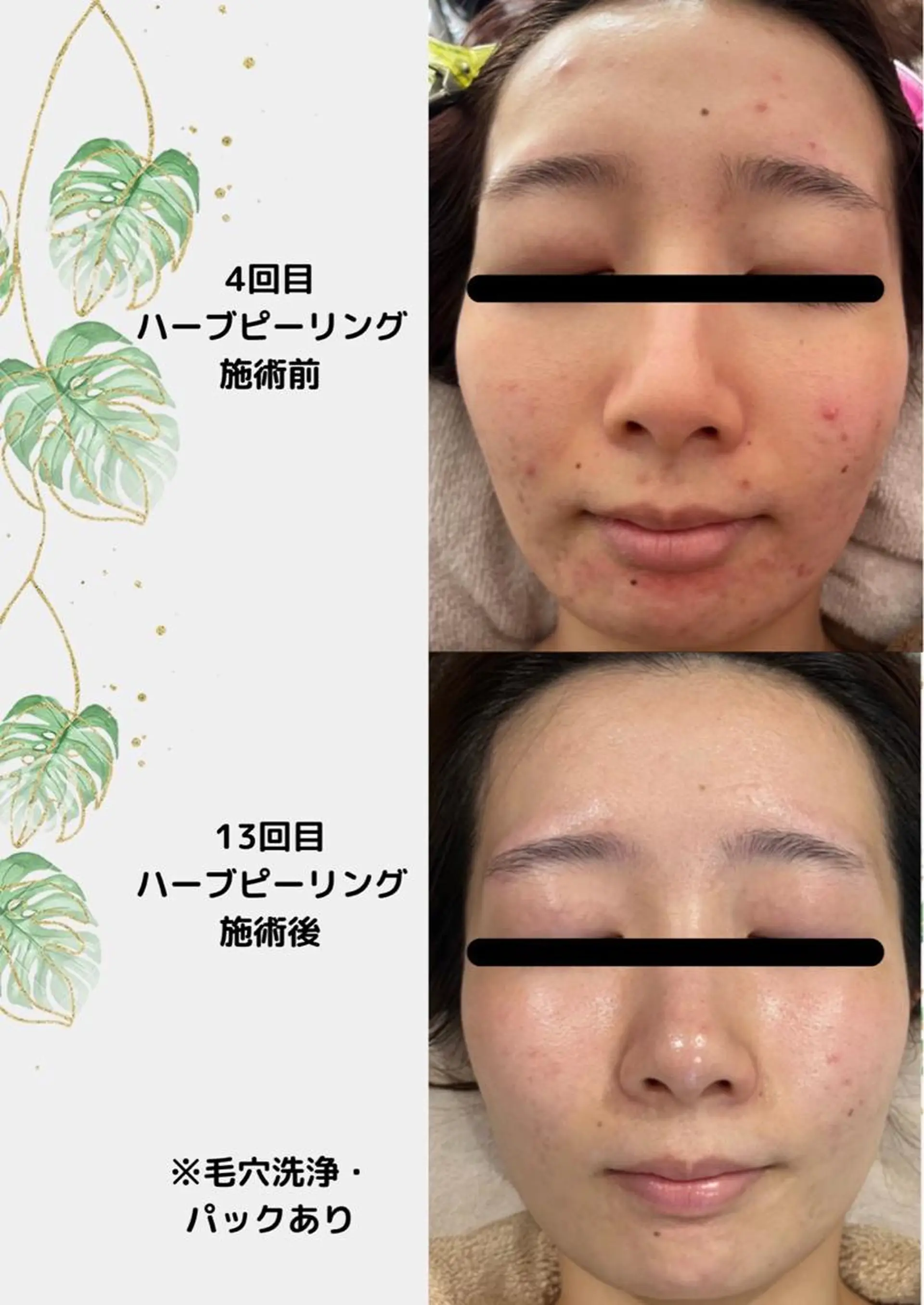 エステ リラク ベルーテ エッセンスのエステ・リラクイメージ