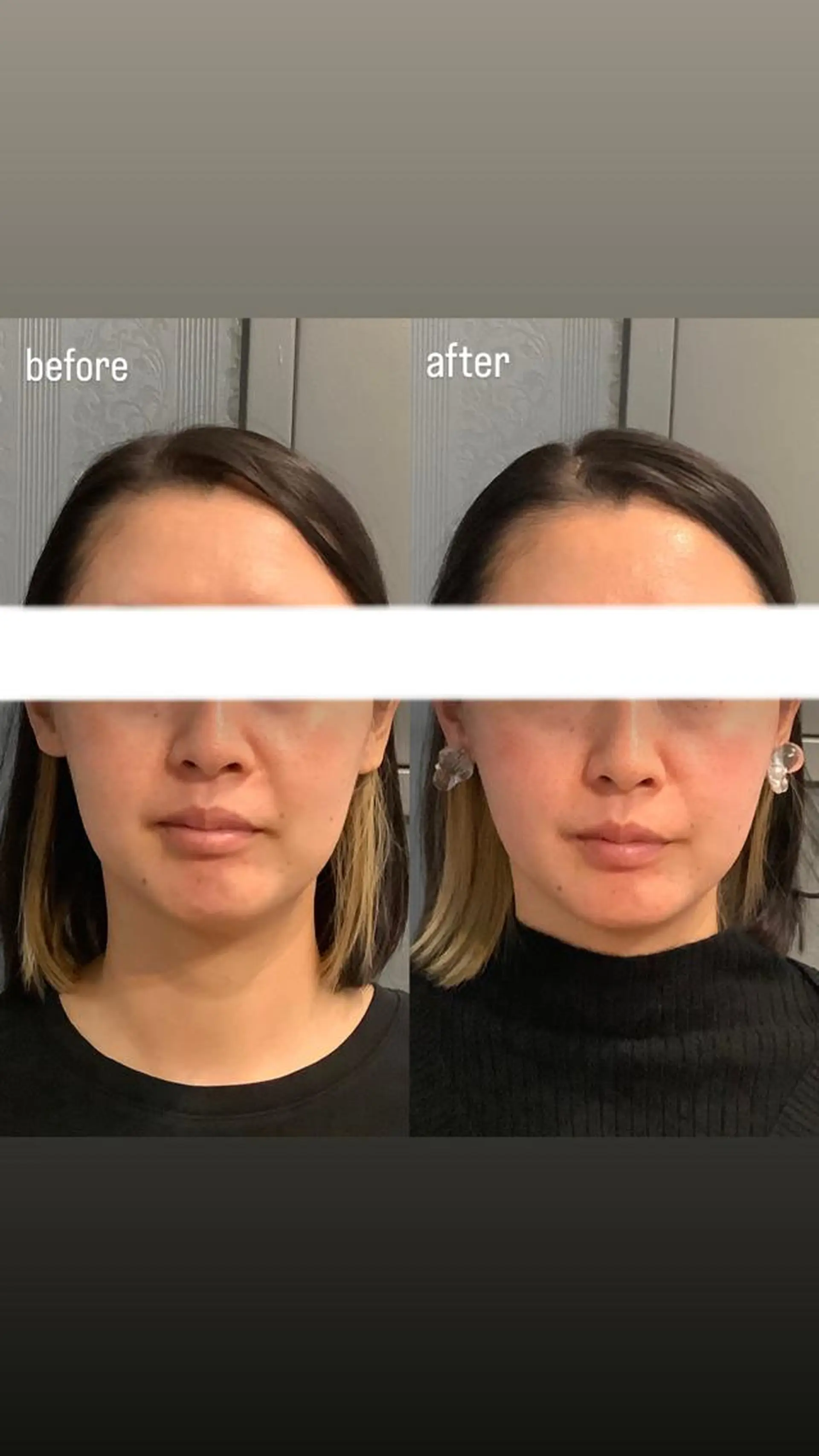 エステ リラク エステサロンino.colore'所属・小顔サロン ino.coloreのエステ・リラクイメージ