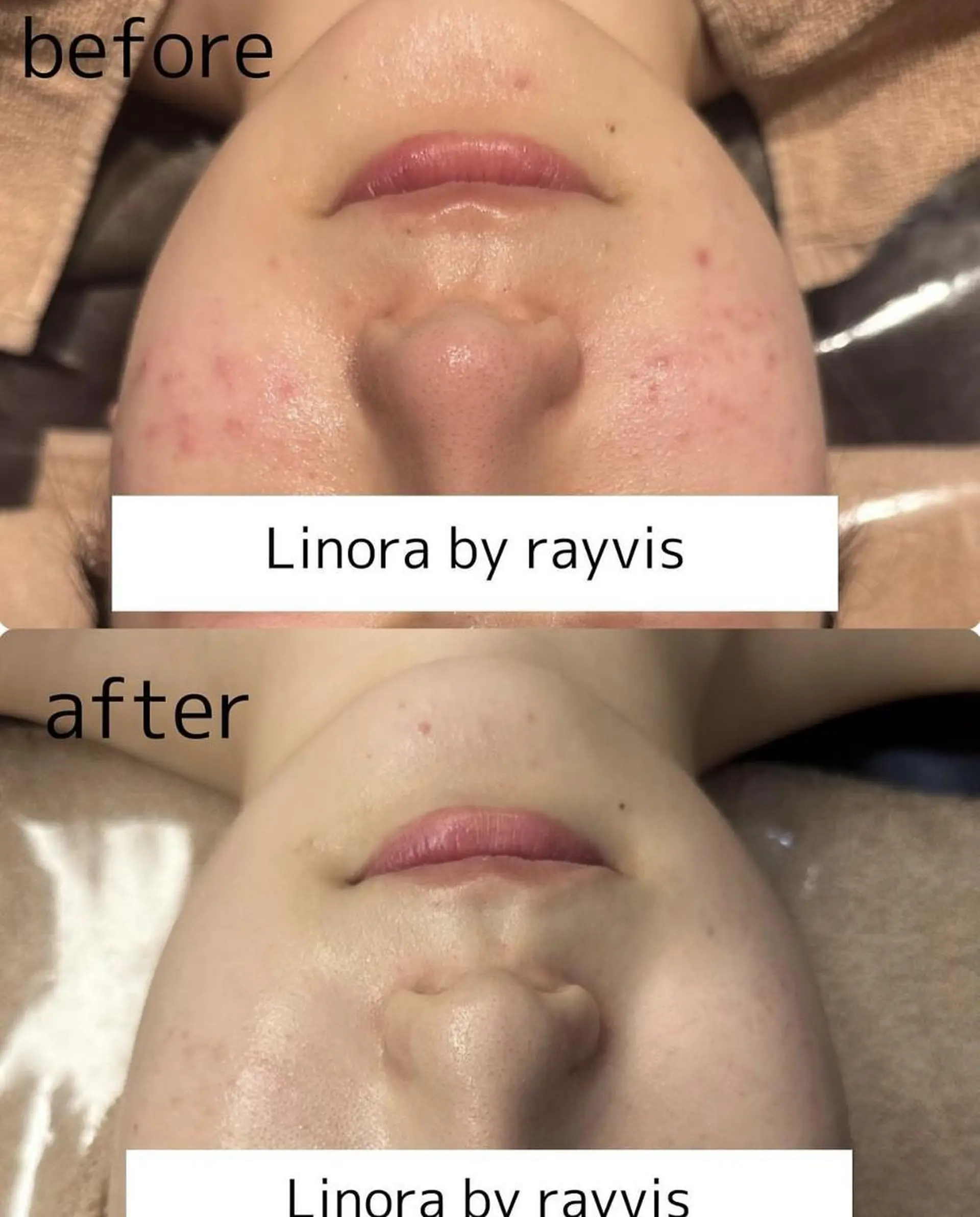 👑Linolaby RAYVIS👑⭐️のエステ・リラクイメージ