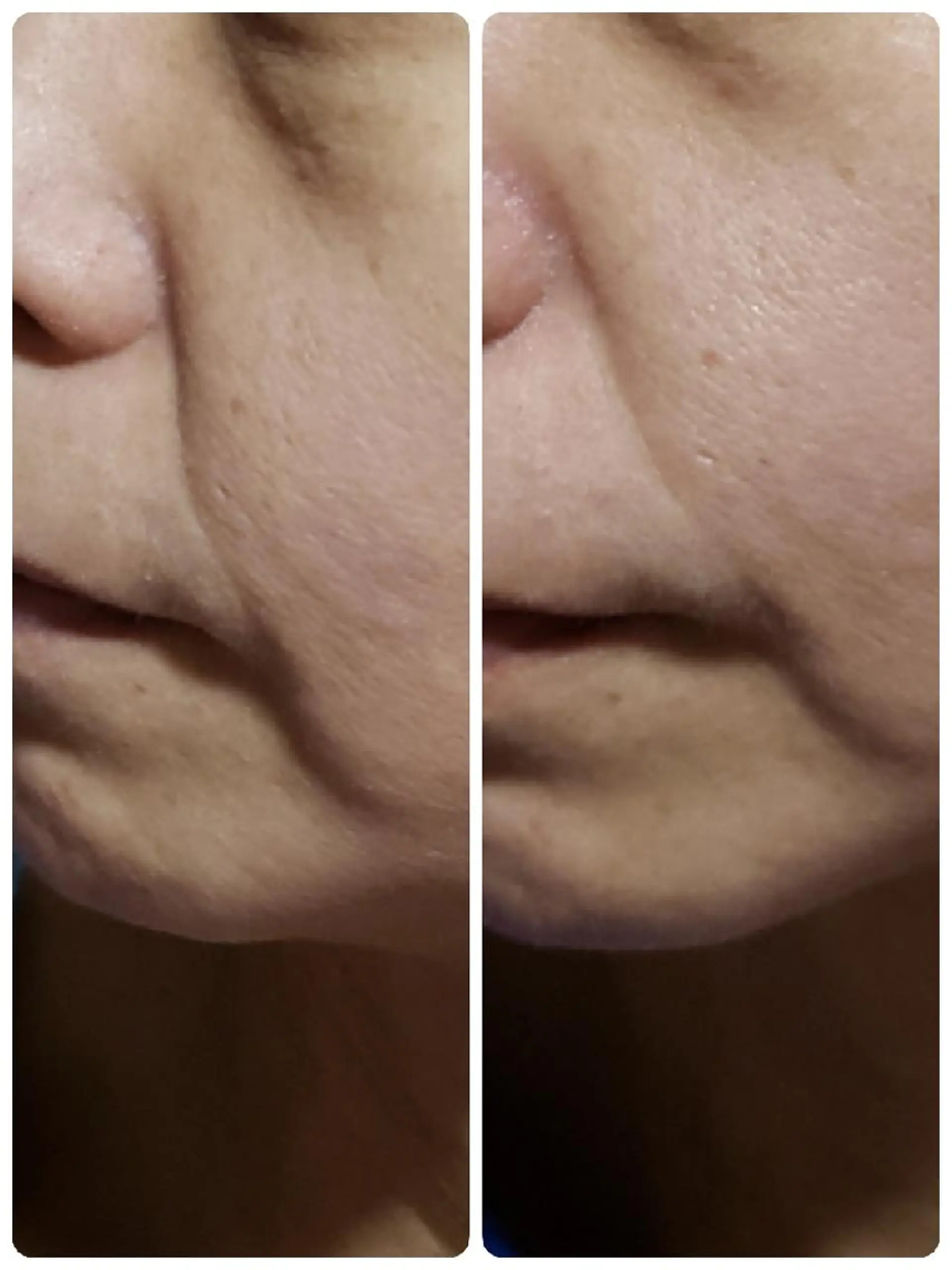 シミシワタルミ改善 美肌サロン松本浩美のエステ・リラクイメージ