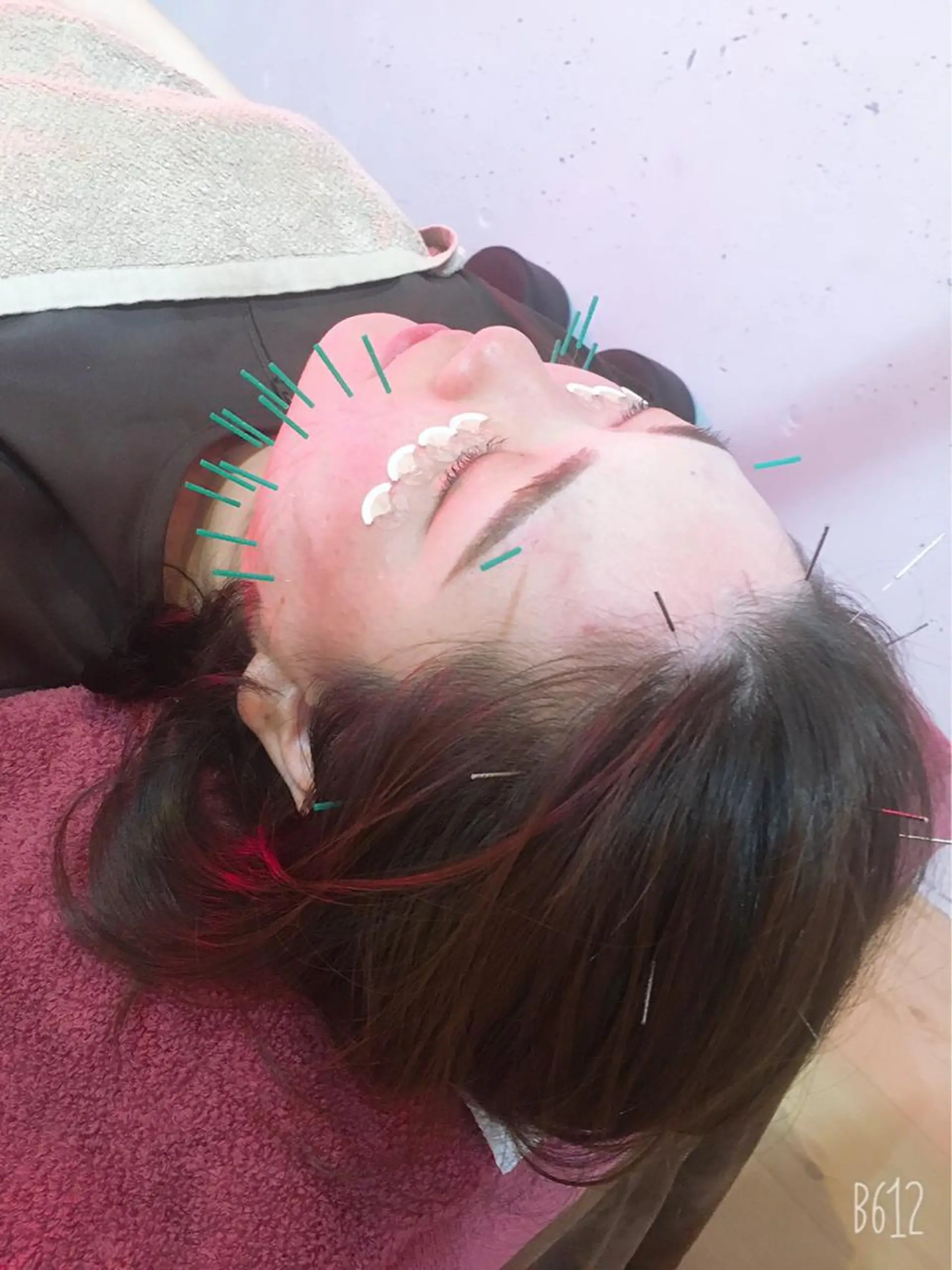 美容鍼灸女性専用 りんご鍼灸治療院のエステ・リラクイメージ