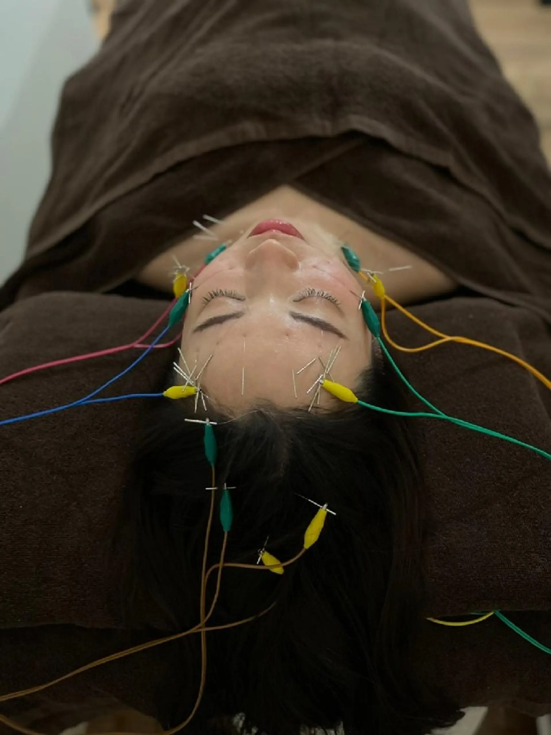 Brilo（ブリーロ）美容鍼灸サロン所属・💙美容鍼💙美顔矯 正🧡Brilo🧡のエステ・リラクイメージ