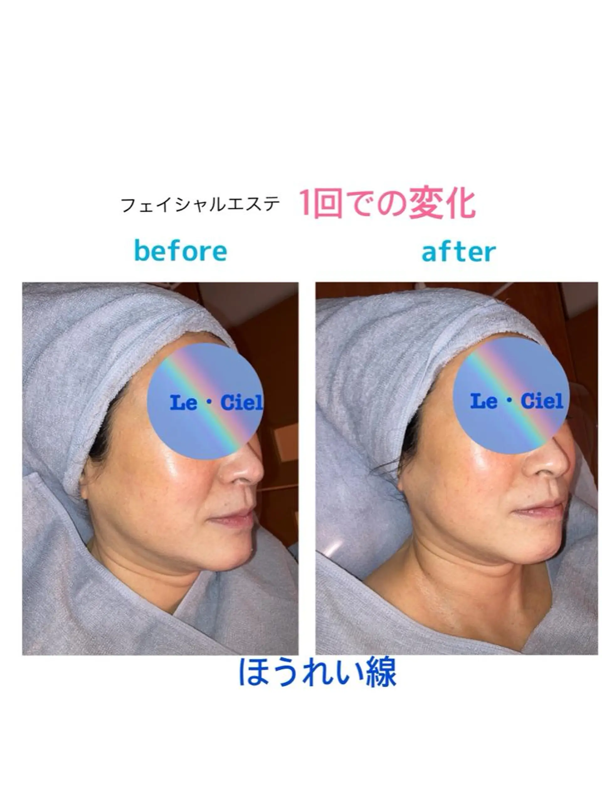 フェイシャルエステLe・Ciel所属・Le・Ciel フェイシャル&ボディのエステ・リラクイメージ