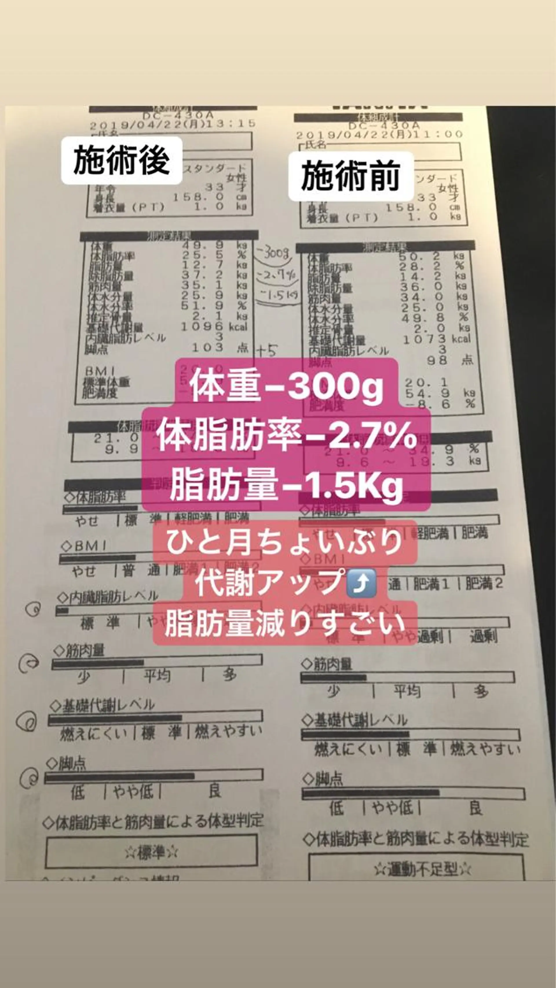 エステ リラク 隠れ家サロン〜MIYU〜所属・うすき隠れ家サロン MIYUのその他イメージ