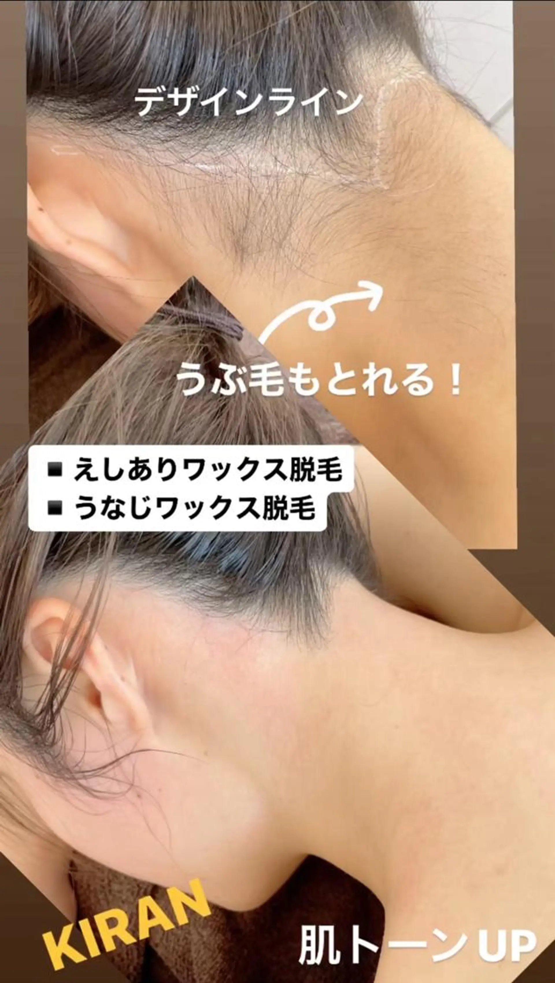 脱毛 KIRAN 山﨑のエステ・リラクイメージ