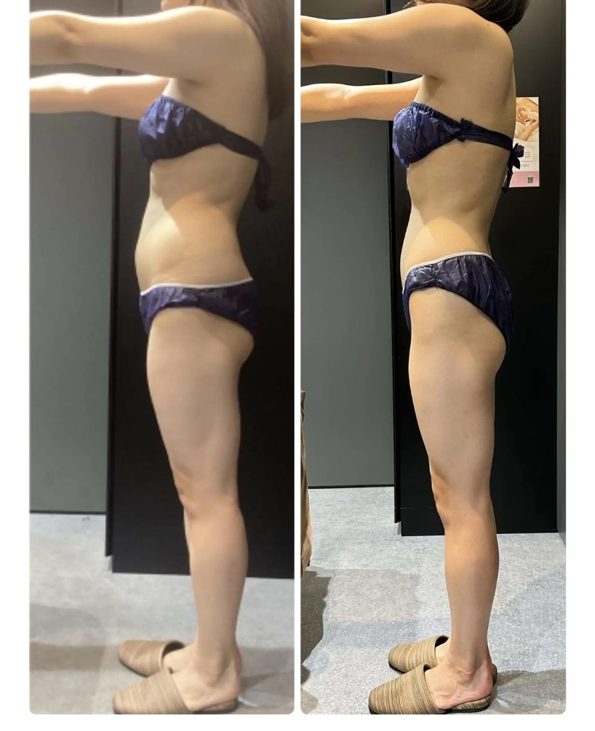 👑Linolaby RAYVIS👑⭐️のエステ・リラクイメージ