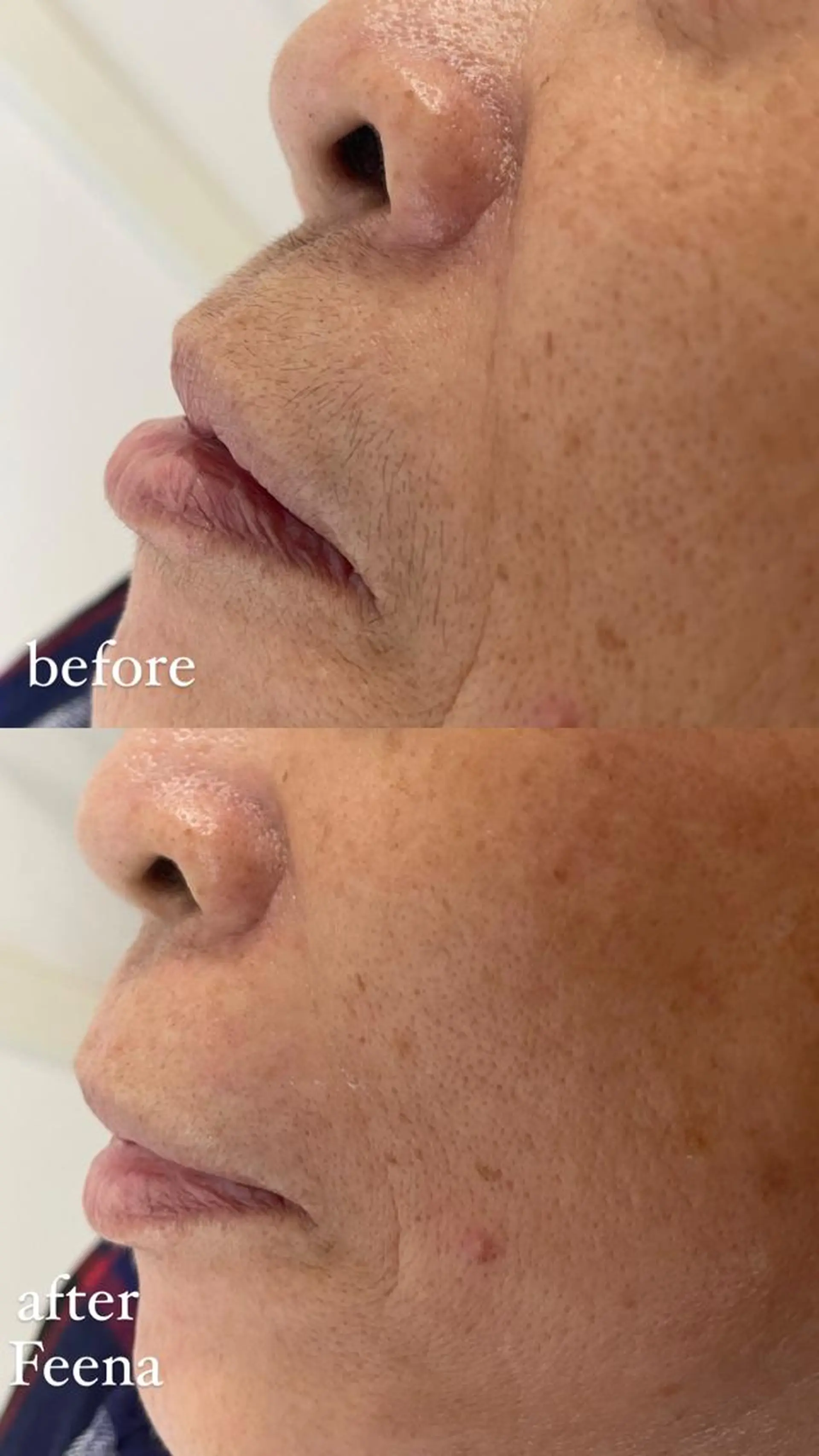 amu nail. RINAのネイルデザイン