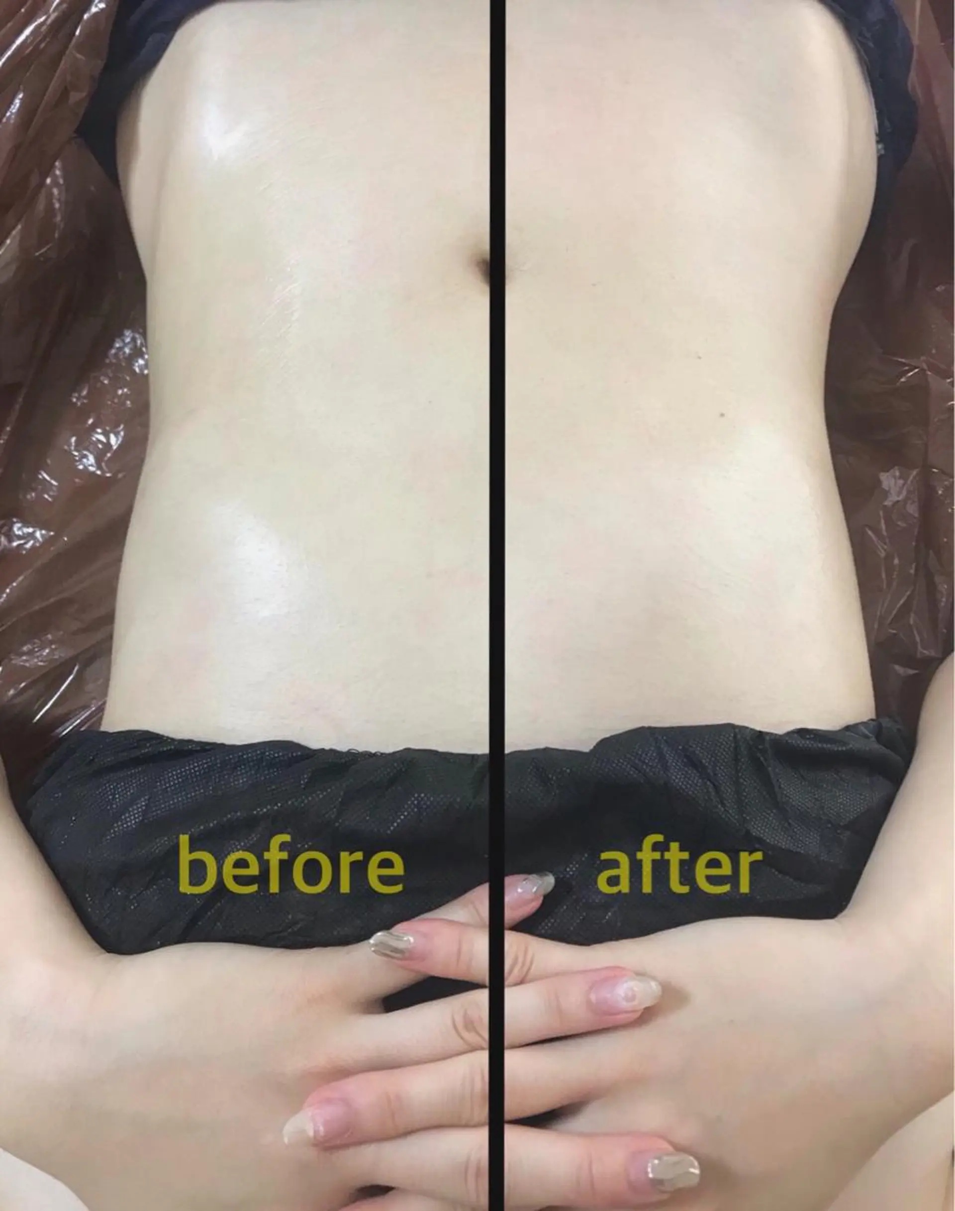 biloop所属・《痩身×疲労改善》 BILOOPのエステ・リラクイメージ