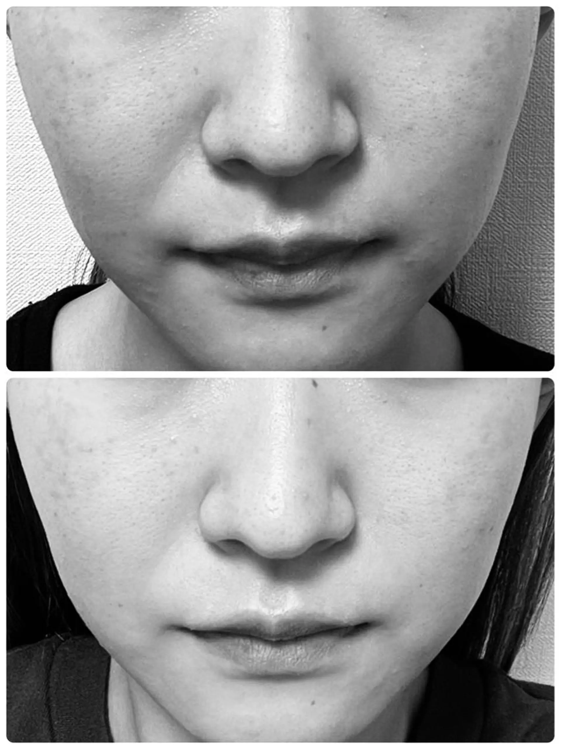 BeSkin藤沢店所属・ニキビ/肌質改善 BeSkin 藤沢店のエステ・リラクイメージ