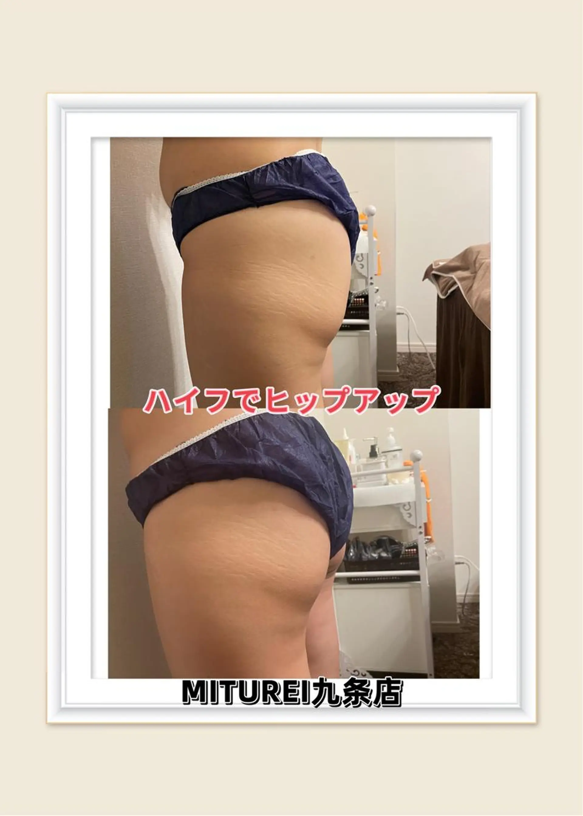 西区九条エステ MITUREIサロンのエステ・リラクイメージ