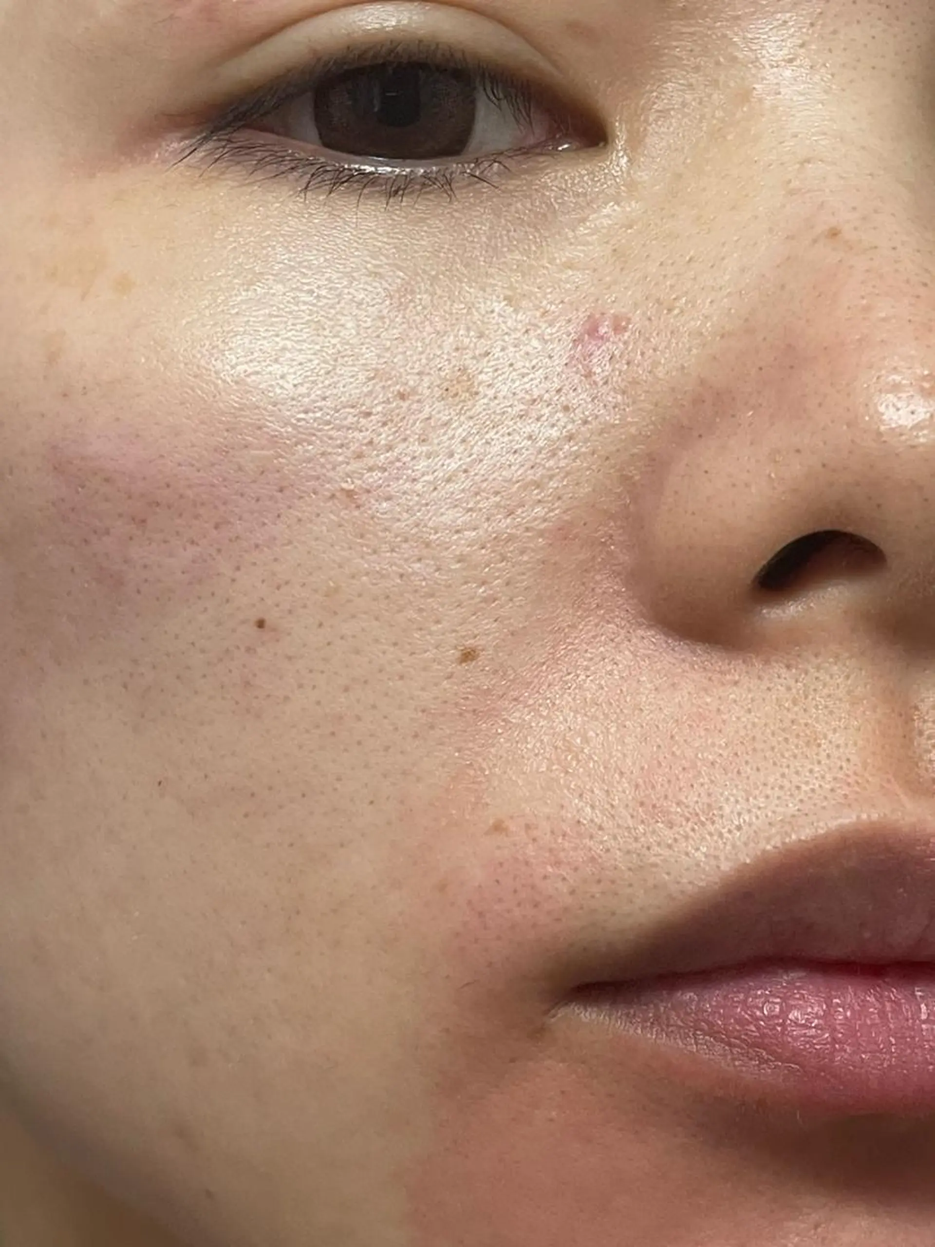 脱毛SALON RaYNiCKのエステ・リラクイメージ