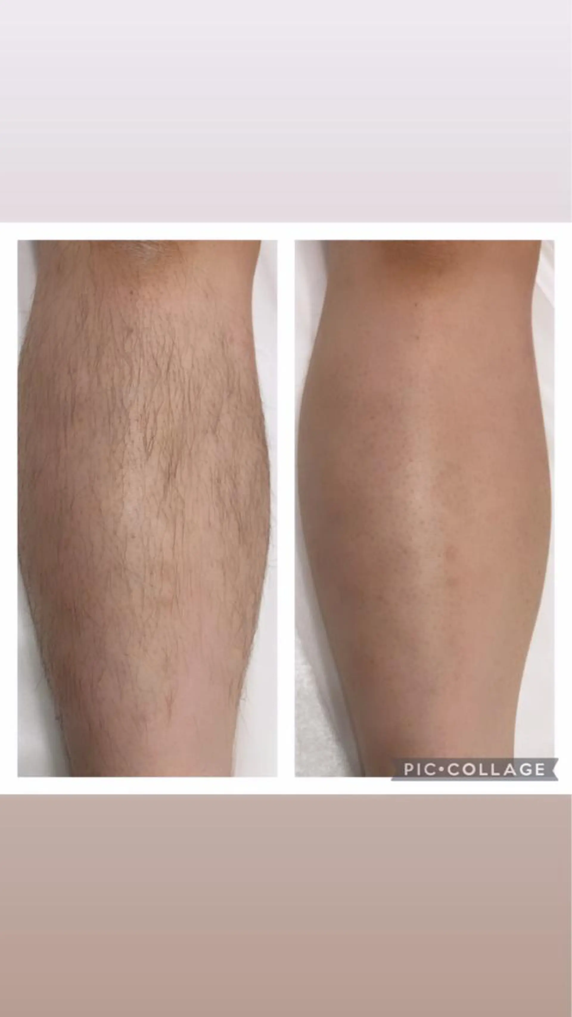 脱毛 MARI シュガーリストのエステ・リラクイメージ