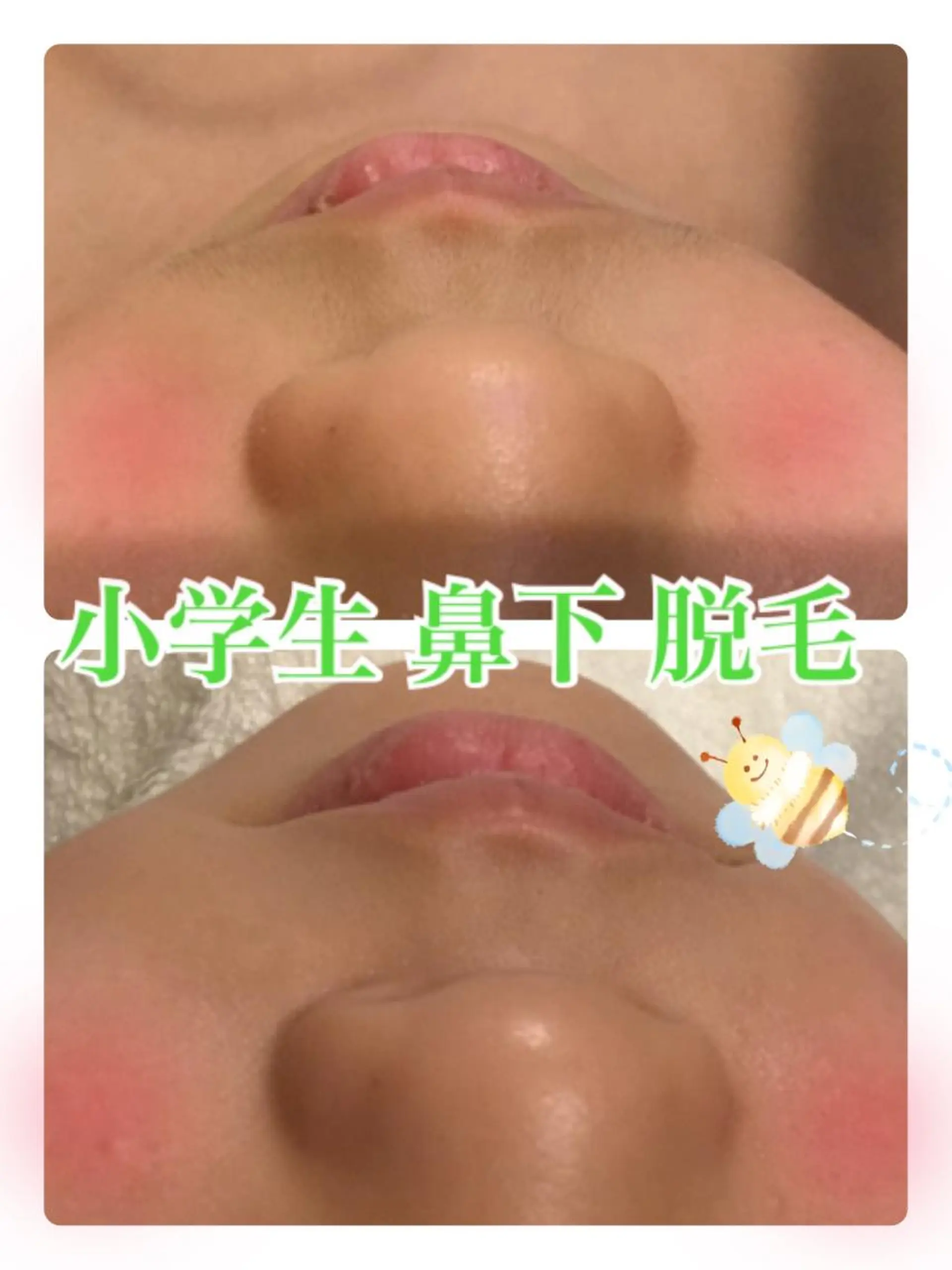 【リベルハーブピーリング認定店】敏感肌・美白脱毛専門店Dione立川店所属・Dione 立川店のエステ・リラクイメージ