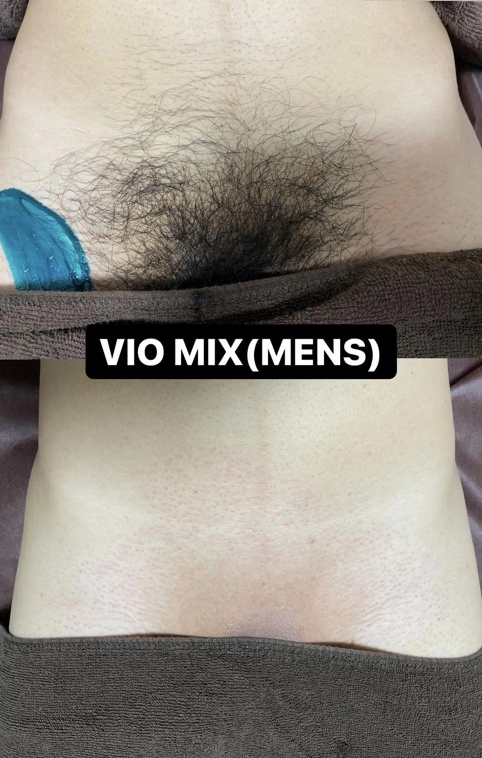 メンズ 脱毛 Epina 千葉店 【エピナ】のエステ・リラクイメージ