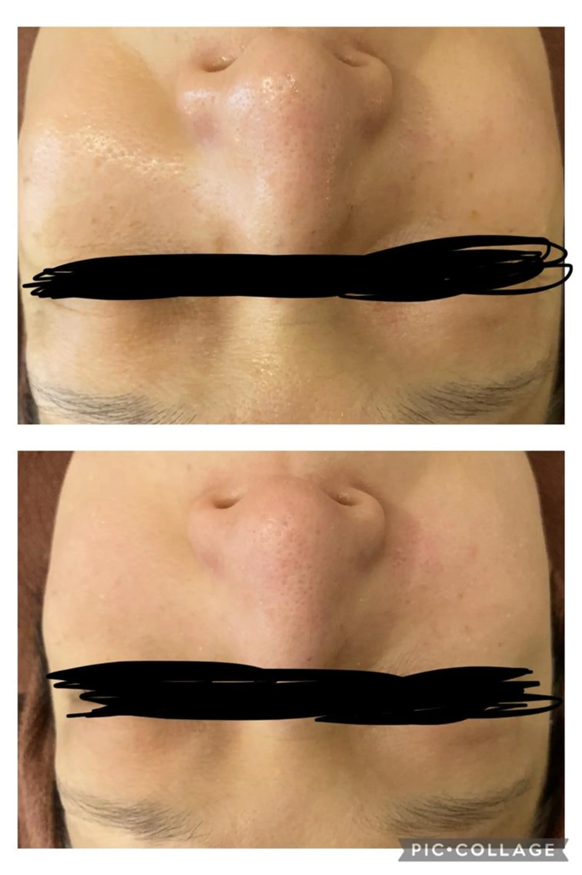 エステ リラク 🔥3か月で肌革命 🔥ニキビ専門店のエステ・リラクイメージ