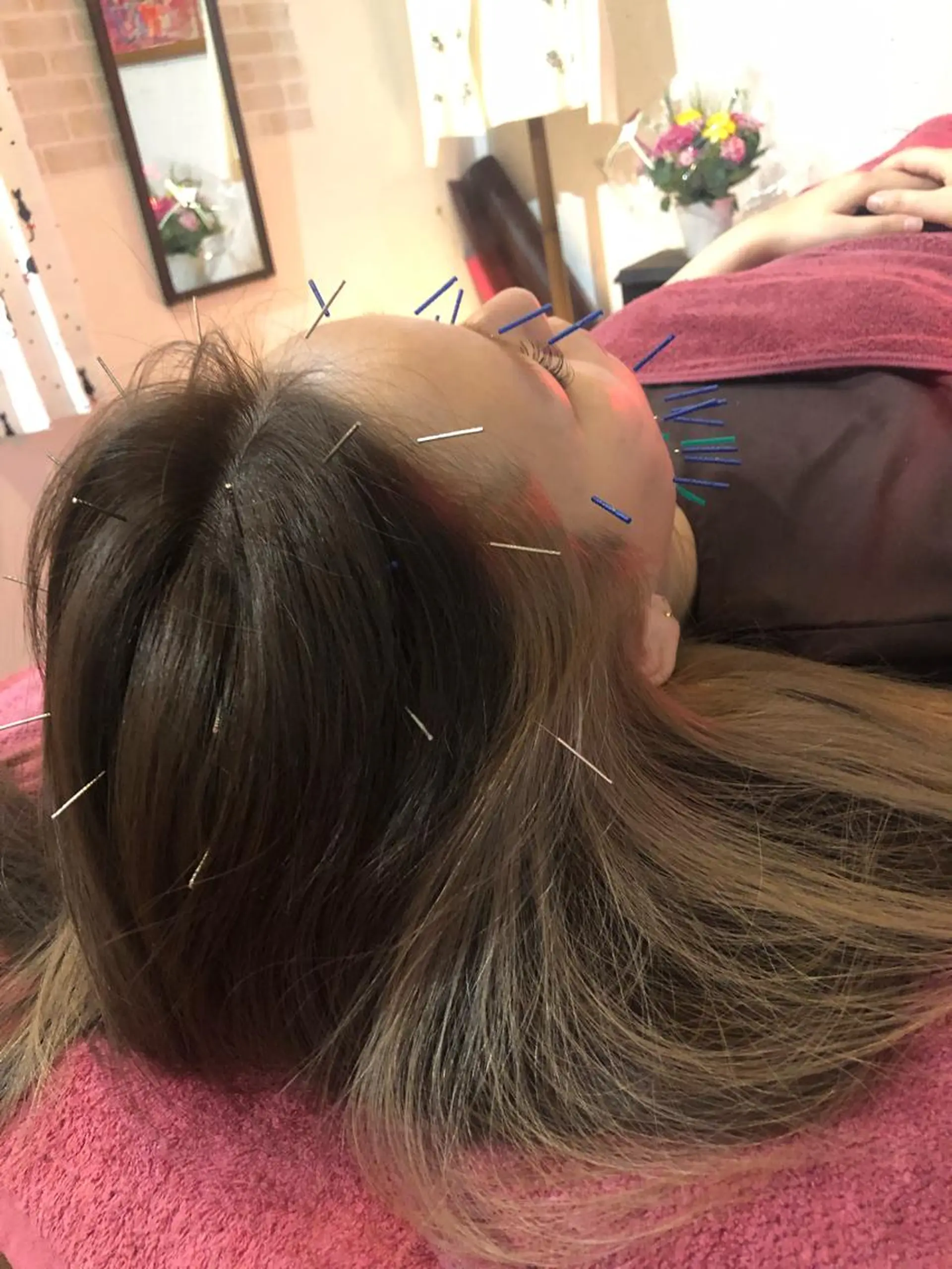 エステ リラク 美容鍼灸女性専用 りんご鍼灸治療院のエステ・リラクイメージ