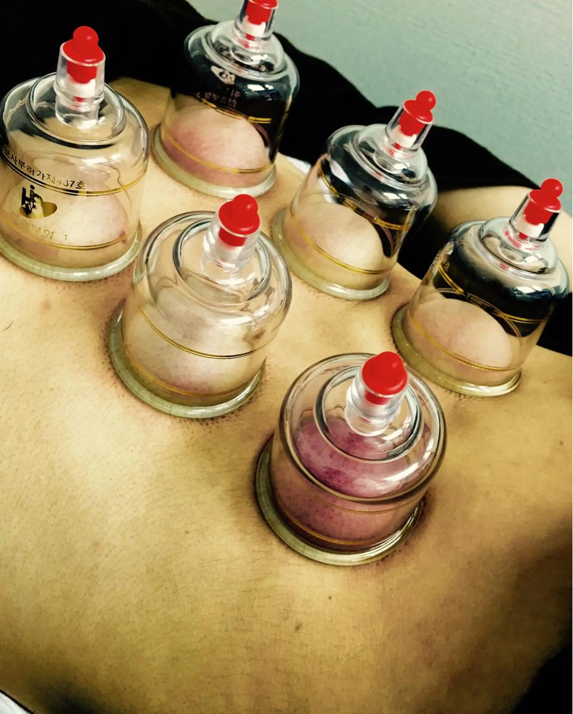 HIRO鍼灸サロン所属・青山 宏のエステ・リラクイメージ