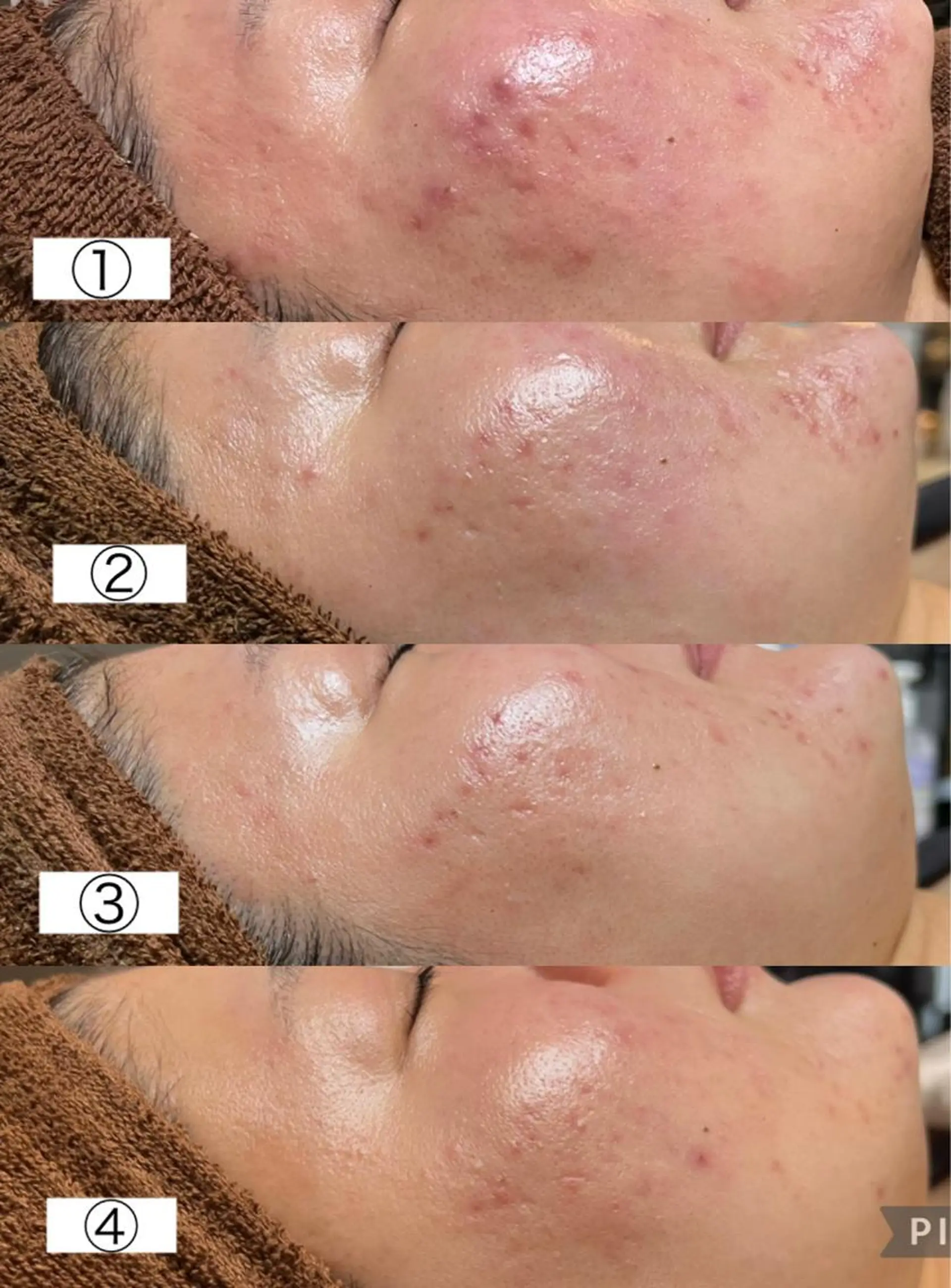 Beauty   Salon  Adiy所属・Adiy ikumiのエステ・リラクイメージ