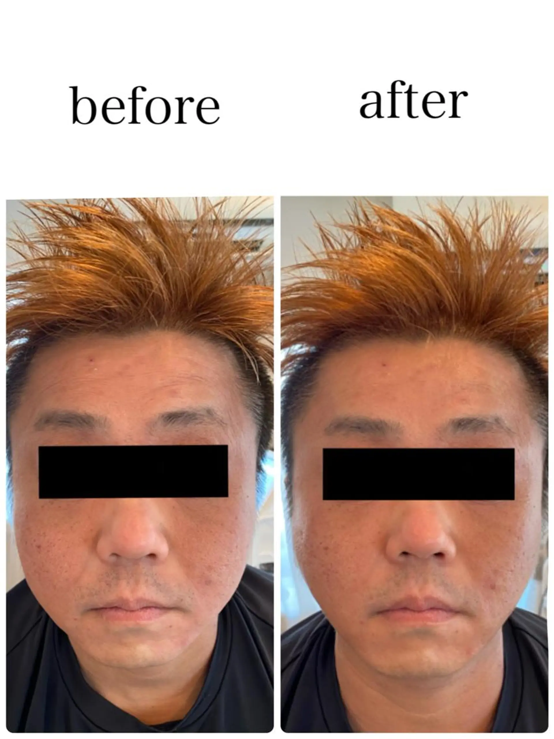 姿勢改善&beauty salon LAUB所属・姿勢改善 サロンLAUB奥村のエステ・リラクイメージ