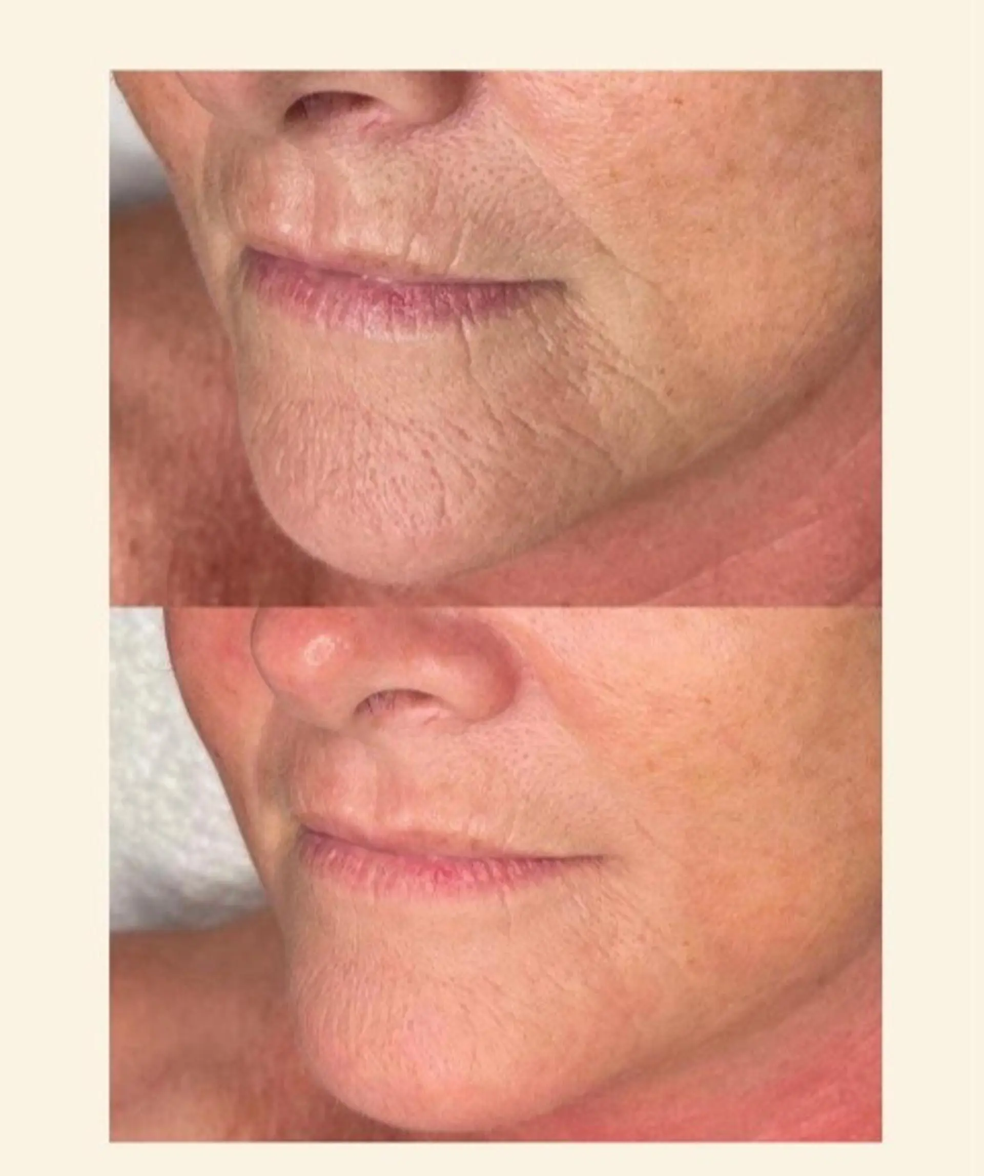 美容鍼灸サロンYOSHINO所属・美容鍼灸サロン YOSHINOのエステ・リラクイメージ