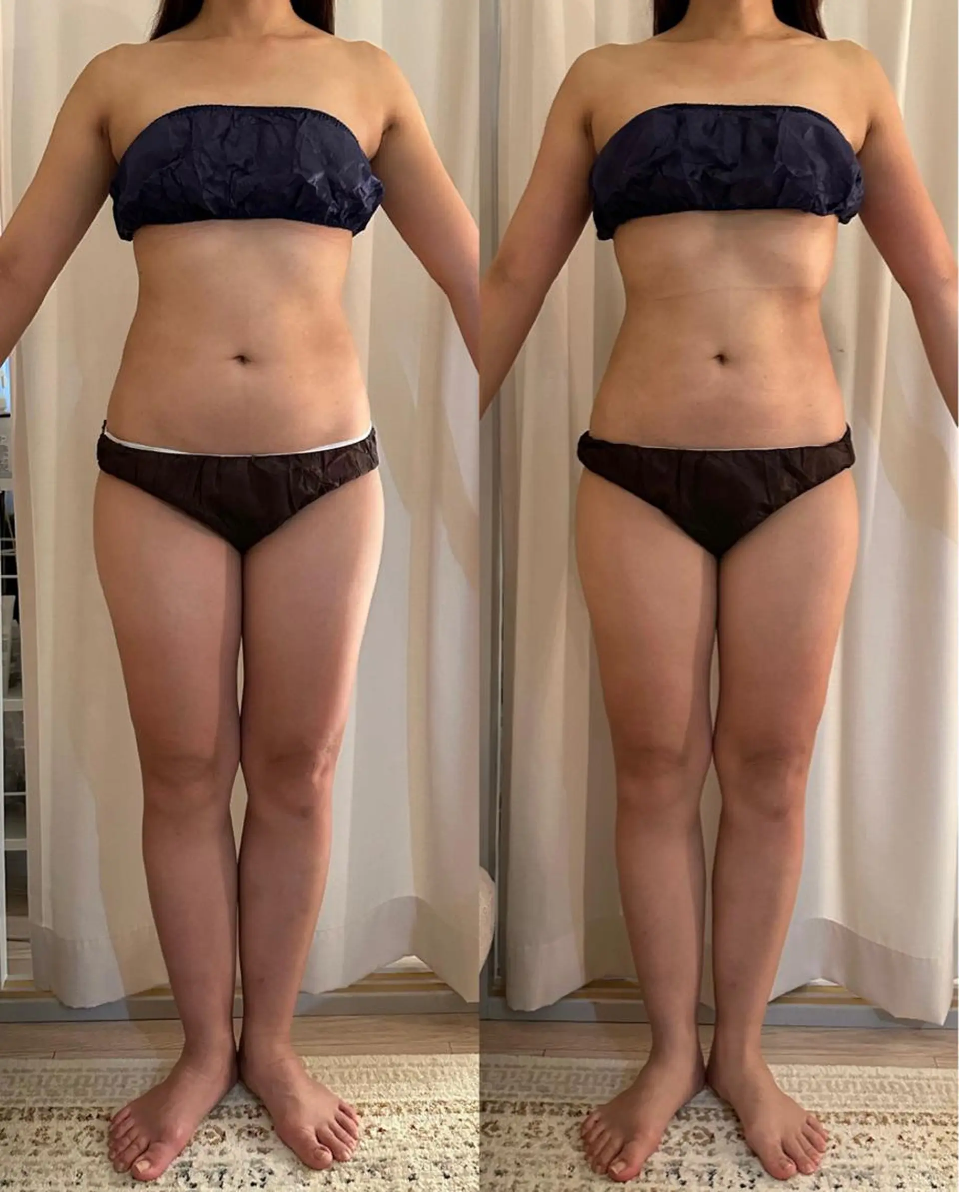 美容鍼灸サロンRemeリミー所属・美容鍼WINBACK サロンRemeのエステ・リラクイメージ