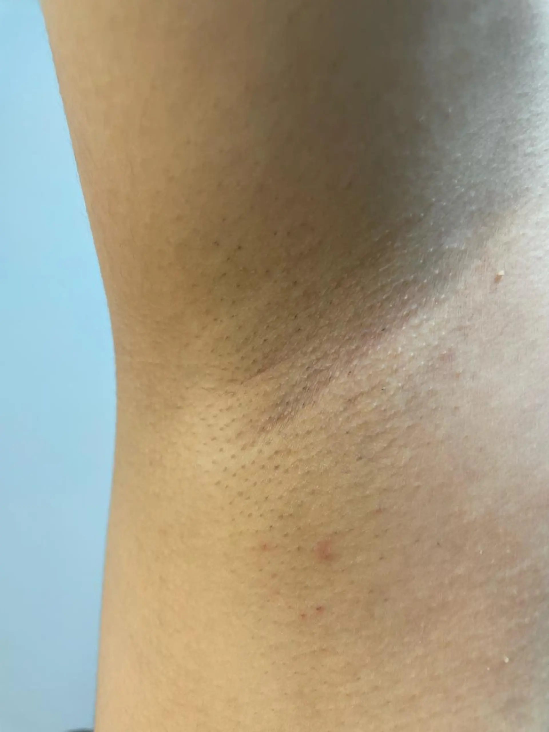 脱毛SALON RaYNiCKのエステ・リラクイメージ