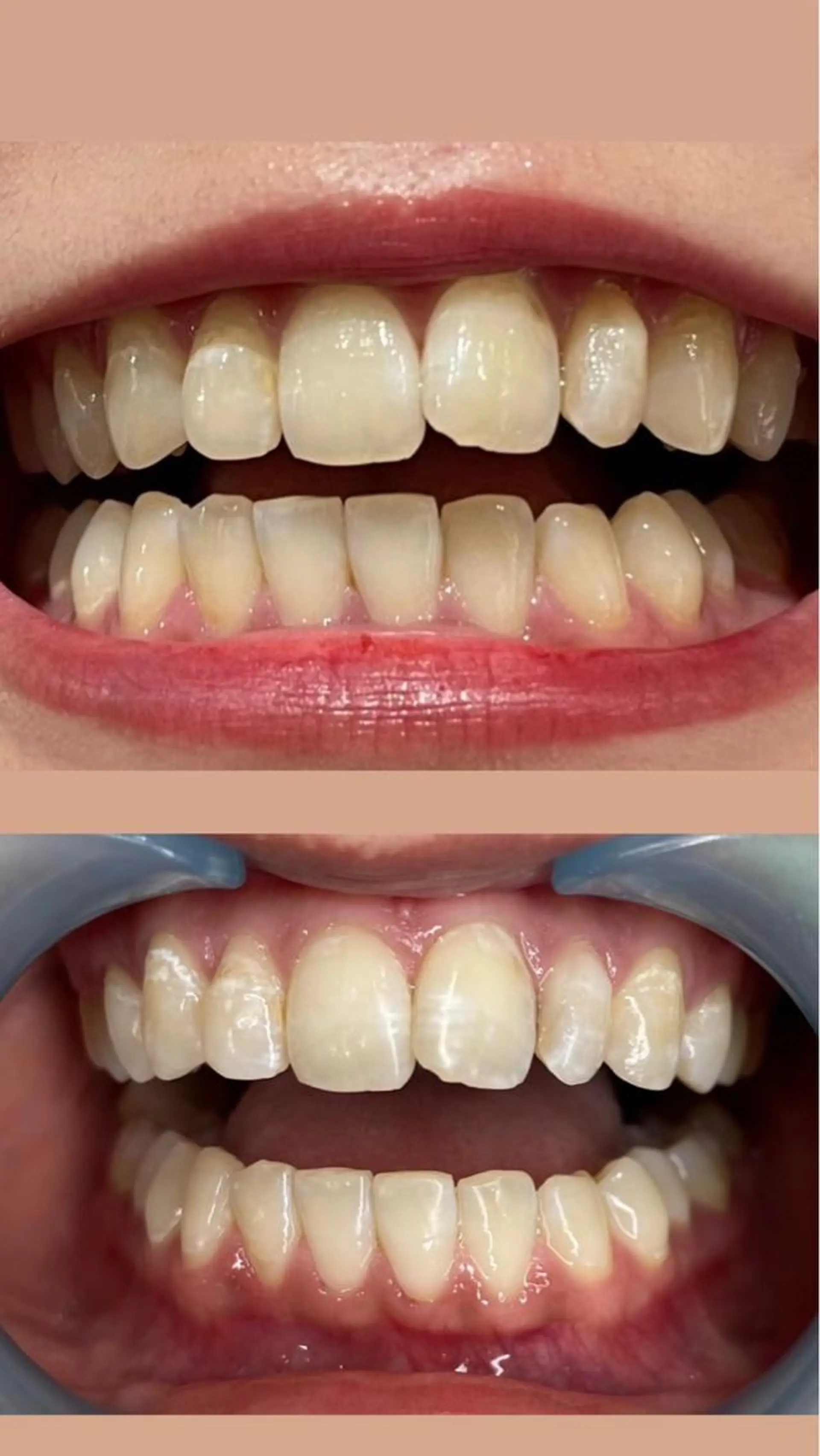 LAVISH nail salonのネイルデザイン